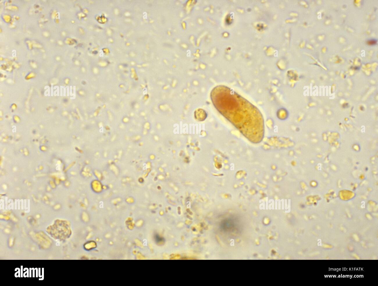 Diese photomicrograph zeigt die Zyste eines Iodamoeba buetschlii amöbische Parasiten. Bild mit freundlicher Genehmigung von CDC/Dr. Mae Melvin, 1977. Stockfoto