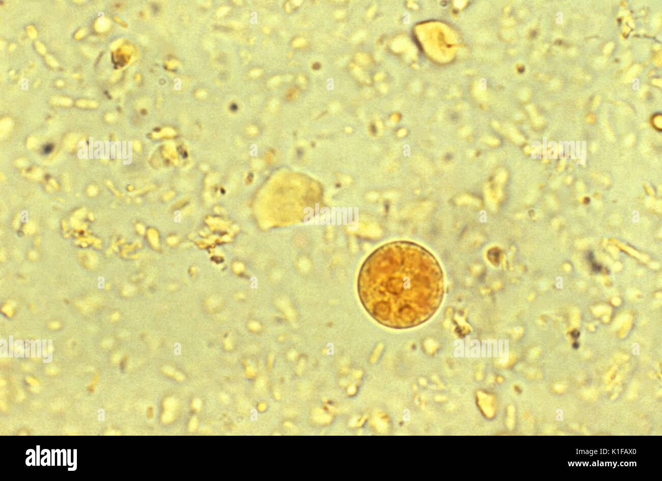 Dieses Jod-gebeizt photomicrograph die Anwesenheit eines Entamoeba histolytica Amöbische parasitäre Zyste offenbart. Diese bestimmten Organismus enthalten drei, deutlich sichtbare Zellkerne, oder trinucleated. Reifen Entamoeba histolytica Zysten haben 4 Kerne, die charakteristisch sind zentral gelegene karyosomes und Fein, gleichmäßig verteilte peripheren Chromatin. Zysten in der Regel messen 12 bis 15{Mikro} m. Bild mit freundlicher Genehmigung von CDC/Dr. Mae Melvin, 1977. Stockfoto