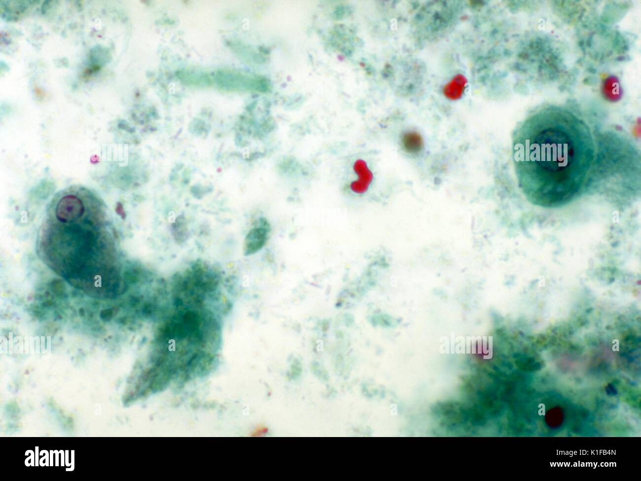 Diese photomicrograph zeigt eine parasitäre Amöbe, Entamoeba histolytica, unter einer Anzahl von Epithelzellen. Bild mit freundlicher Genehmigung von CDC/Dr. Mae Melvin, 1977. Stockfoto