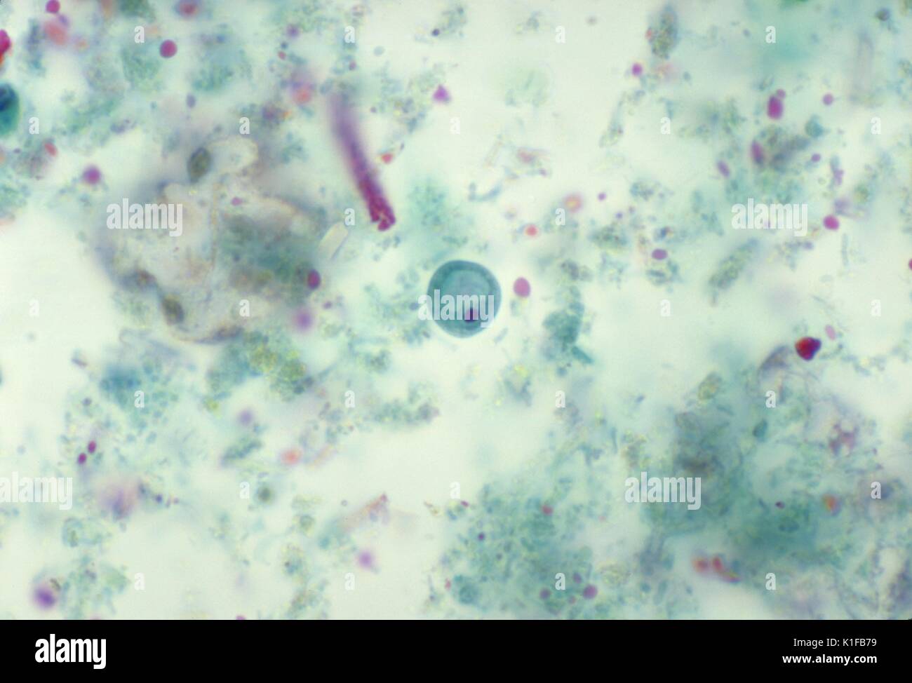 Diese photomicrograph zeigt die Zyste eines Iodamoeba buetschlii parasitäre Amöbe. Bild mit freundlicher Genehmigung von CDC/Dr. Mae Melvin, 1977. Stockfoto