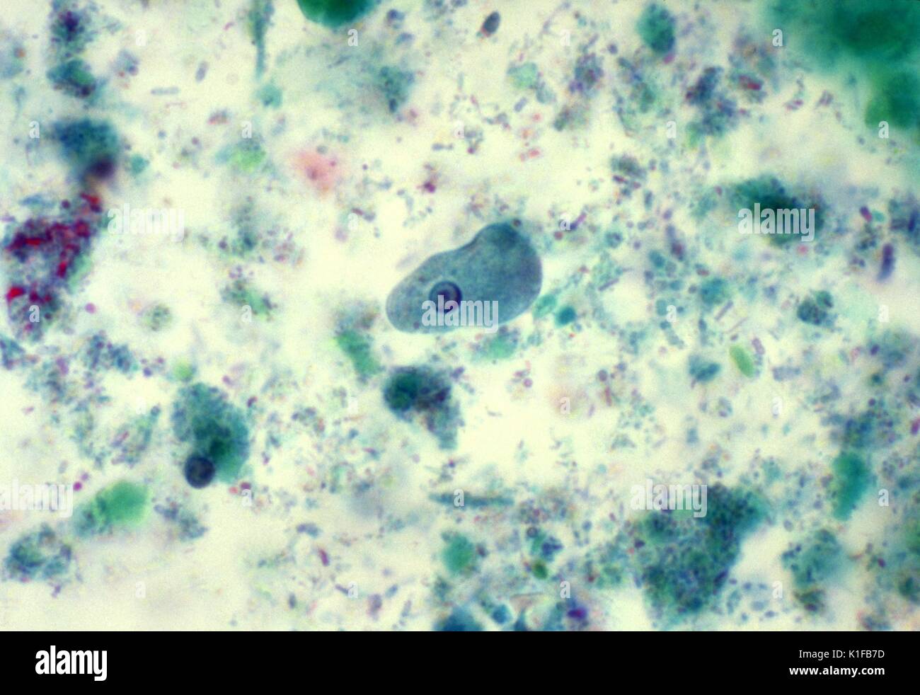 Entamoeba histolytica trophozoite angezeigt atypische mit dem Zellkern und der Ungleichmäßigen peripheren Chromatin. Entamoeba histolytica trophozoite angezeigt atypische Kern mit ungleichen peripheren Chromatin. Parasiten, Amöben. Bild mit freundlicher Genehmigung von CDC/Dr. Mae Melvin, 1977. Stockfoto