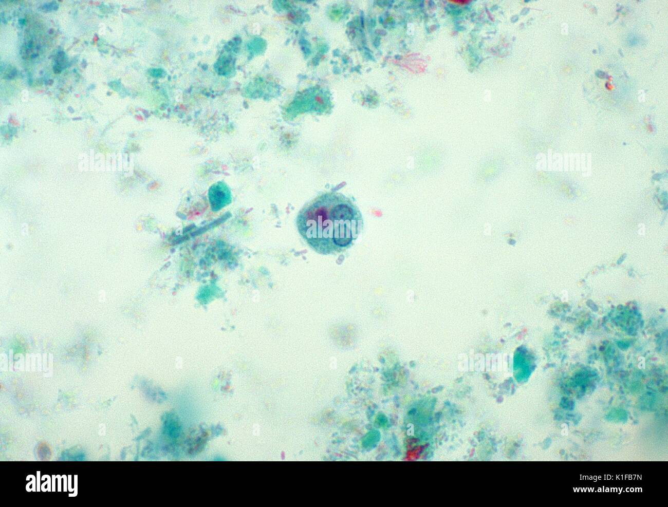 Diese trichrom-gebeizt binucleated photomicrograph schildert eine Zyste der amöbische Parasit Entamoeba histolytica. In hell - Bereich Mikroskopie, E. histolytica Zysten sind in der Regel kugelförmig und messen 12 bis 15{Mikro} m (Reichweite kann 10 bis 20{Mikro} m sein). Eine ausgereifte Zyste hat 4 Kerne, während einer unreifen Zyste nur 1 bis 3 Kerne enthalten kann. Periphere Chromatin ist fein, einheitliche und gleichmäßig verteilt. Länglich, chromatoid Stellen mit unverblümt abgerundete Enden manchmal gefunden werden kann. Glykogen diffundieren oder in reife Zysten abwesend sein, während in unreifen Zysten Verklumpten. Bild mit freundlicher Genehmigung von CDC/Dr. Mae Melvin, 1977. Stockfoto