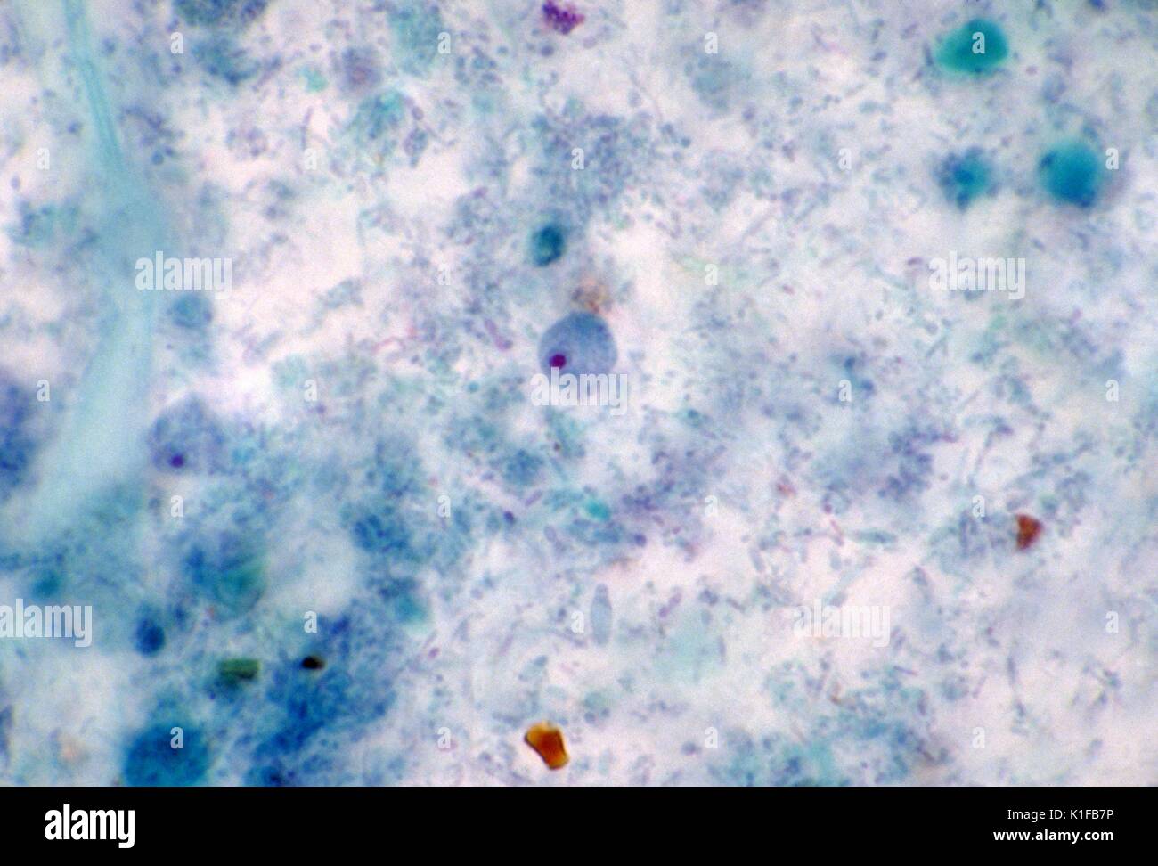 Diese photomicrograph schildert ein amöbische Parasiten, Endolimax nana, trophozoite. Bild mit freundlicher Genehmigung von CDC/Dr. Mae Melvin, 1982. Stockfoto