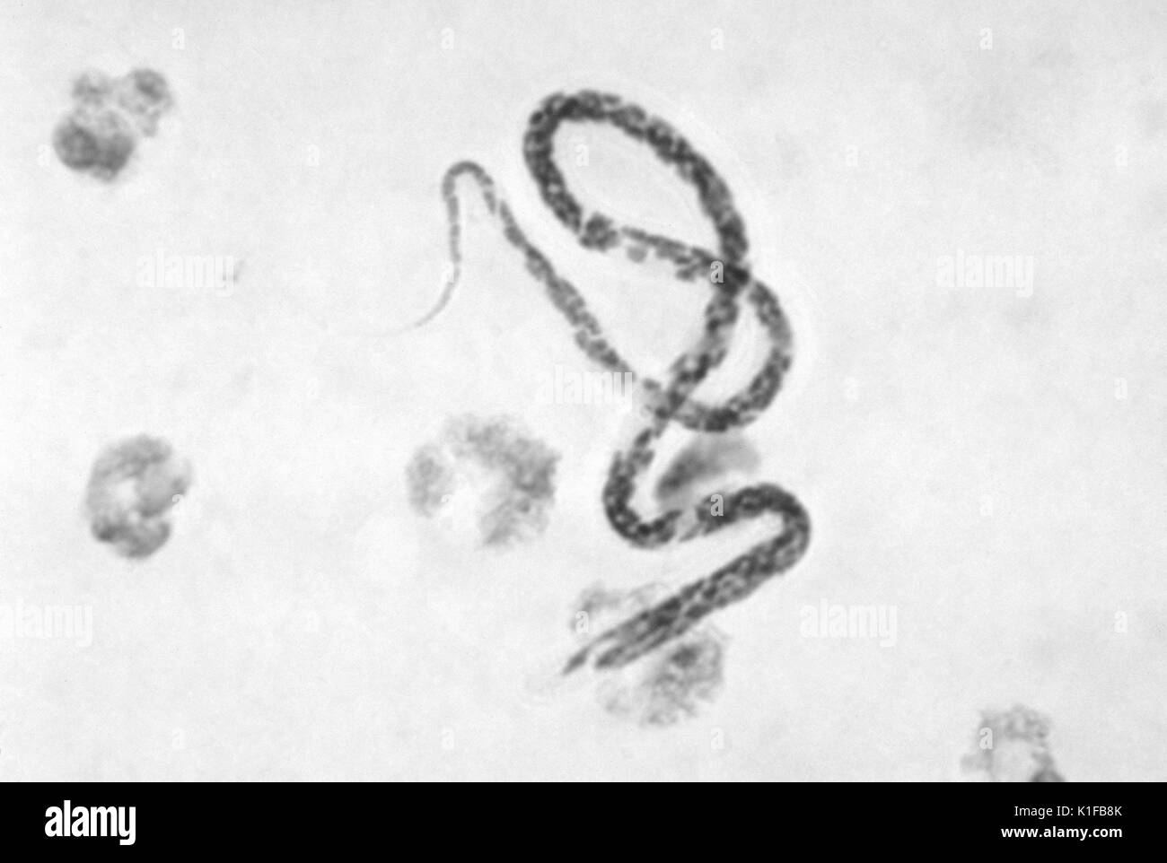 Diese photomicrograph zeigt die Mansonella ozzardi microfilaria dieser Parasit. Bild mit freundlicher Genehmigung von CDC/Dr. Mae Melvin, 1979. Stockfoto
