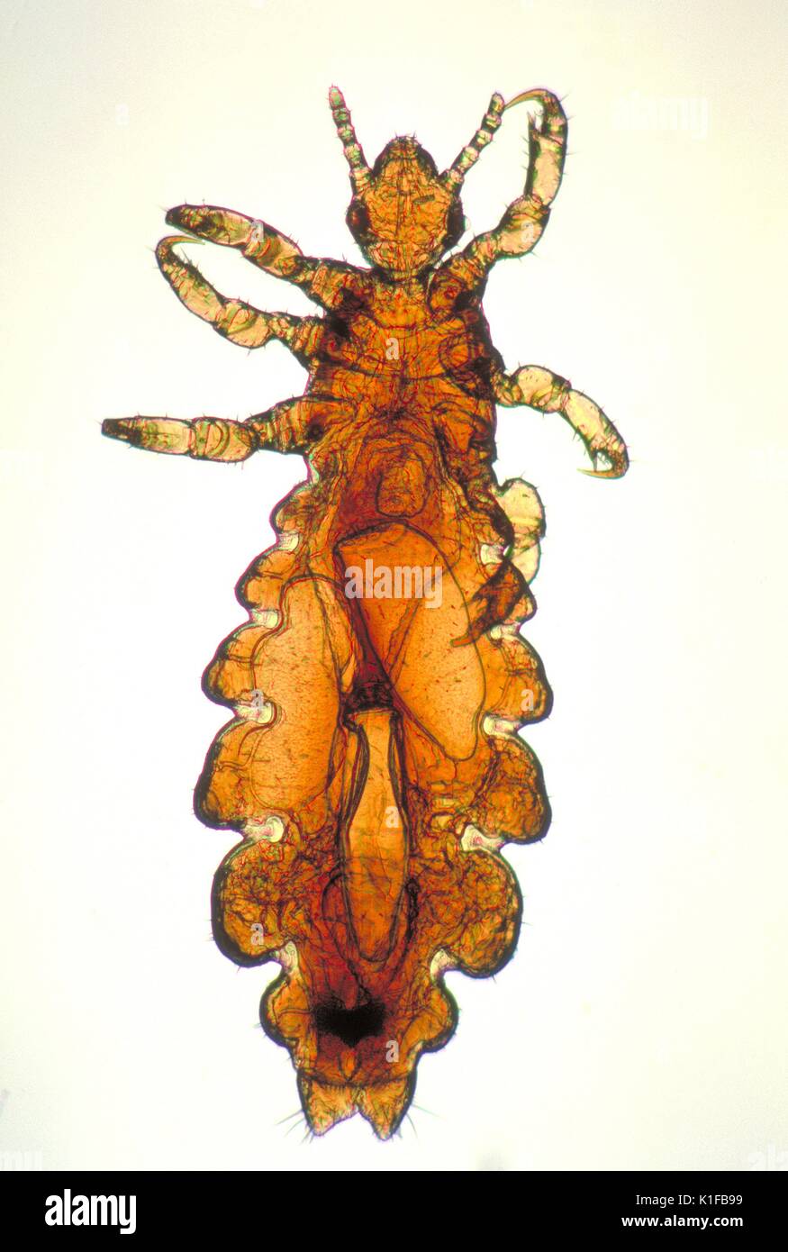 Dieses Bild zeigt eine dorsalansicht Für eine weibliche Kopflaus, Pediculus humanus capitis Div. Läuse sind parasitäre Insekten, die auf die Köpfe der Menschen gefunden werden können, und Einrichtungen, einschließlich der Schambereich. Die Läuse überleben durch die Fütterung von menschlichem Blut. Läuse gefunden auf jeder Bereich des Körpers voneinander unterscheiden. Die drei Arten der Läuse, die auf Menschen leben sind:. Bild mit freundlicher Genehmigung von CDC/Dr. Dennis D. Juranek, 1979. Stockfoto