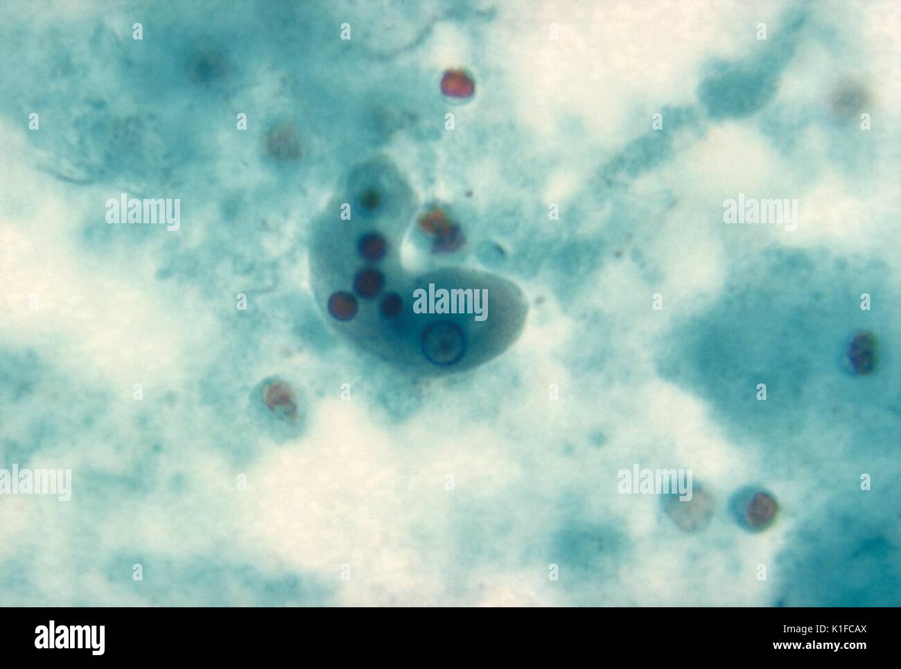 Dieses Bild zeigte eine trophozoite eines Entamoeba histolytica einzelliger Parasit. Wenn trophozoiten bleiben dem Darmlumen beschränkt, wie der Fall eines?nichtinvasive? Intestinale Amöbiasis, betroffene Personen Asymptomatische Träger geworden, vorbei an Zysten in ihren Stuhl und damit in der Lage, Nahrungsmittel und Wasser zu verschmutzen, über ungewaschene Hände. Bild mit freundlicher Genehmigung von CDC/Dr. N.J. Wheeler, Jr 1982. Stockfoto