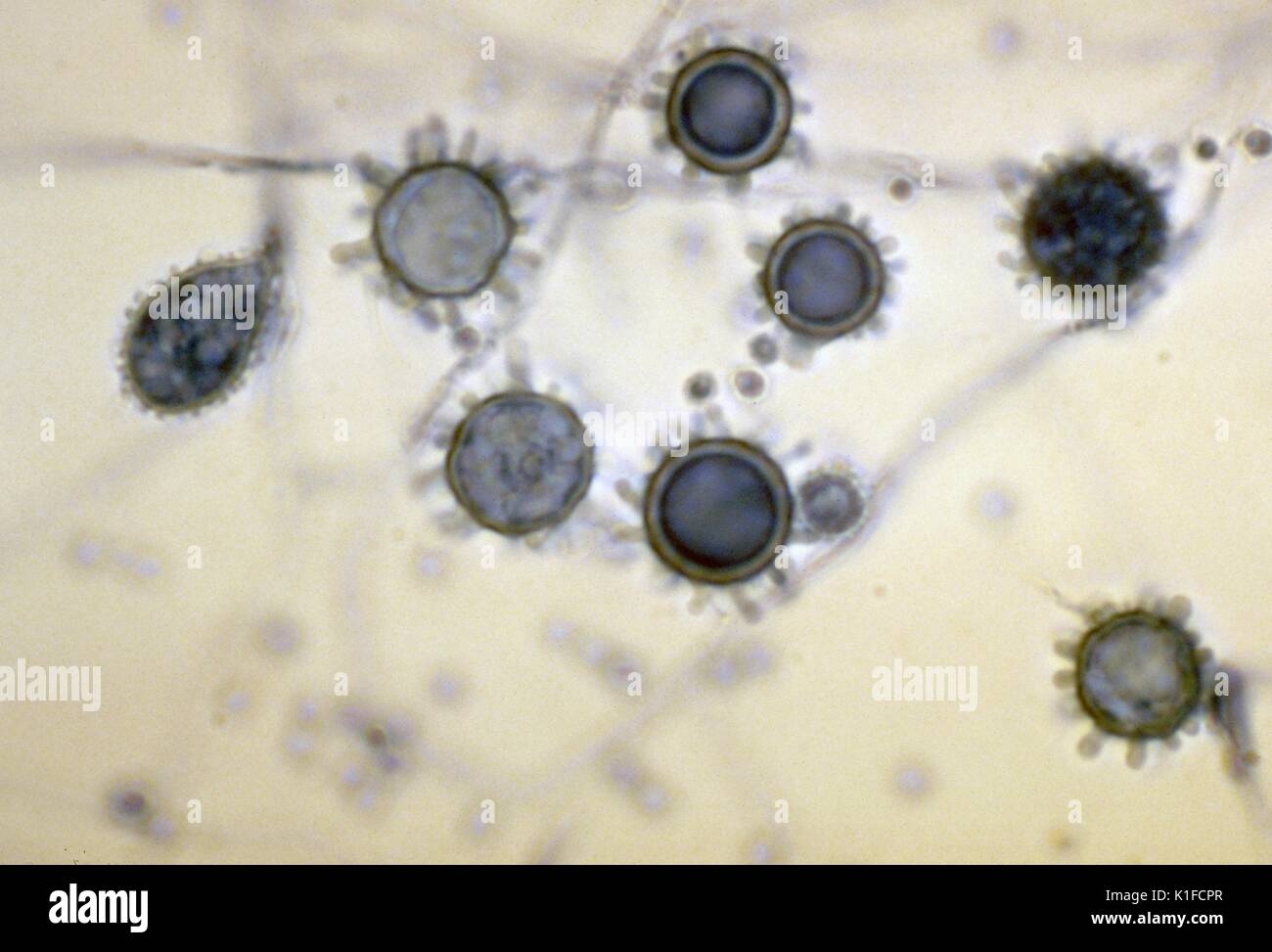 Asexuell Sporen (konidien): tuberculate macroconidia von Histoplasma capsulatum. Microconidia sind ebenfalls vorhanden. Mit freundlicher CDC. 1982. Stockfoto