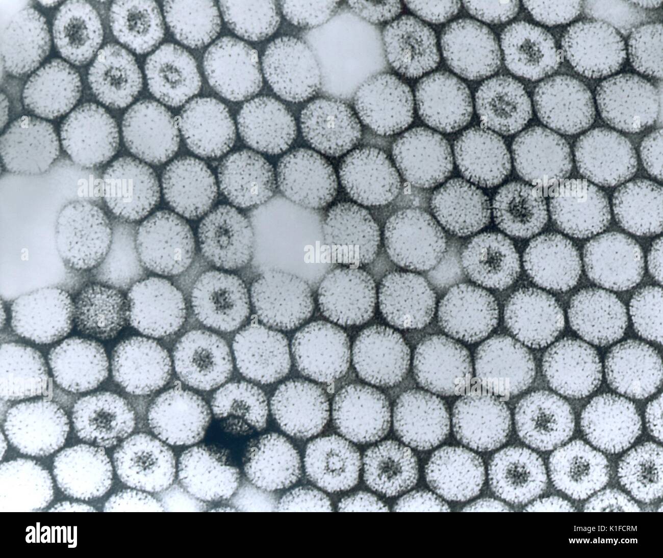 Diese Transmission Electron Micrograph (TEM) dargestellten Zahlen des reovirus Typ 3 Virionen. Transmission Electron Micrograph des reovirus Typ 3. Sowohl die inneren als auch die äußeren capsid Tanks vorhanden sind. Einige Virionen sind durch negative Fleck eingedrungen. Bild mit freundlicher Genehmigung von CDC/Dr. Erskine Palmer, 1981. Stockfoto