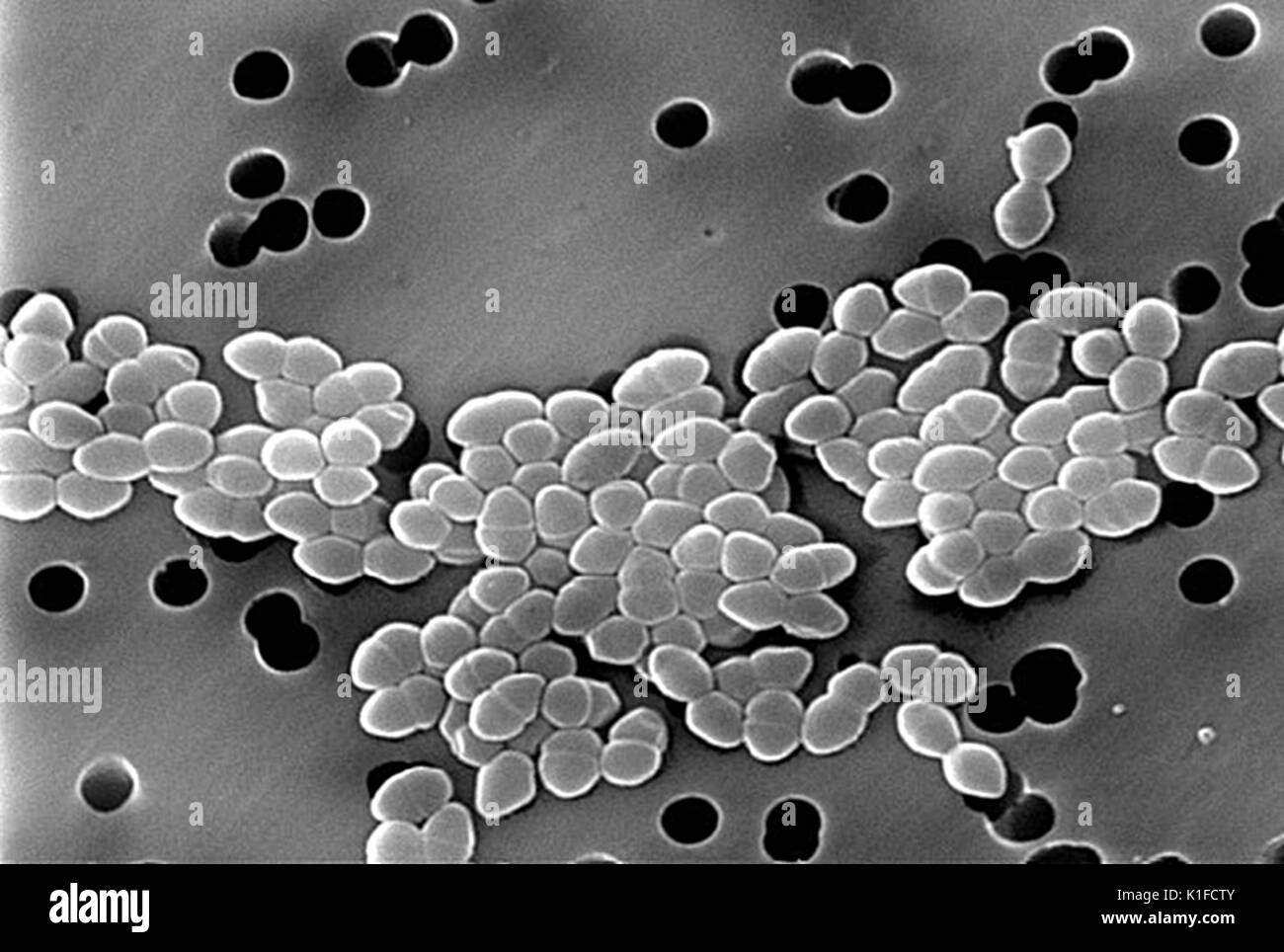 Scanning Electron Micrograph (SEM) von Vancomycin resistente Gram-positive Bakterien Enterokokken Sp.. Mit freundlicher CDC/Janice Haney Carr. 1982. Stockfoto