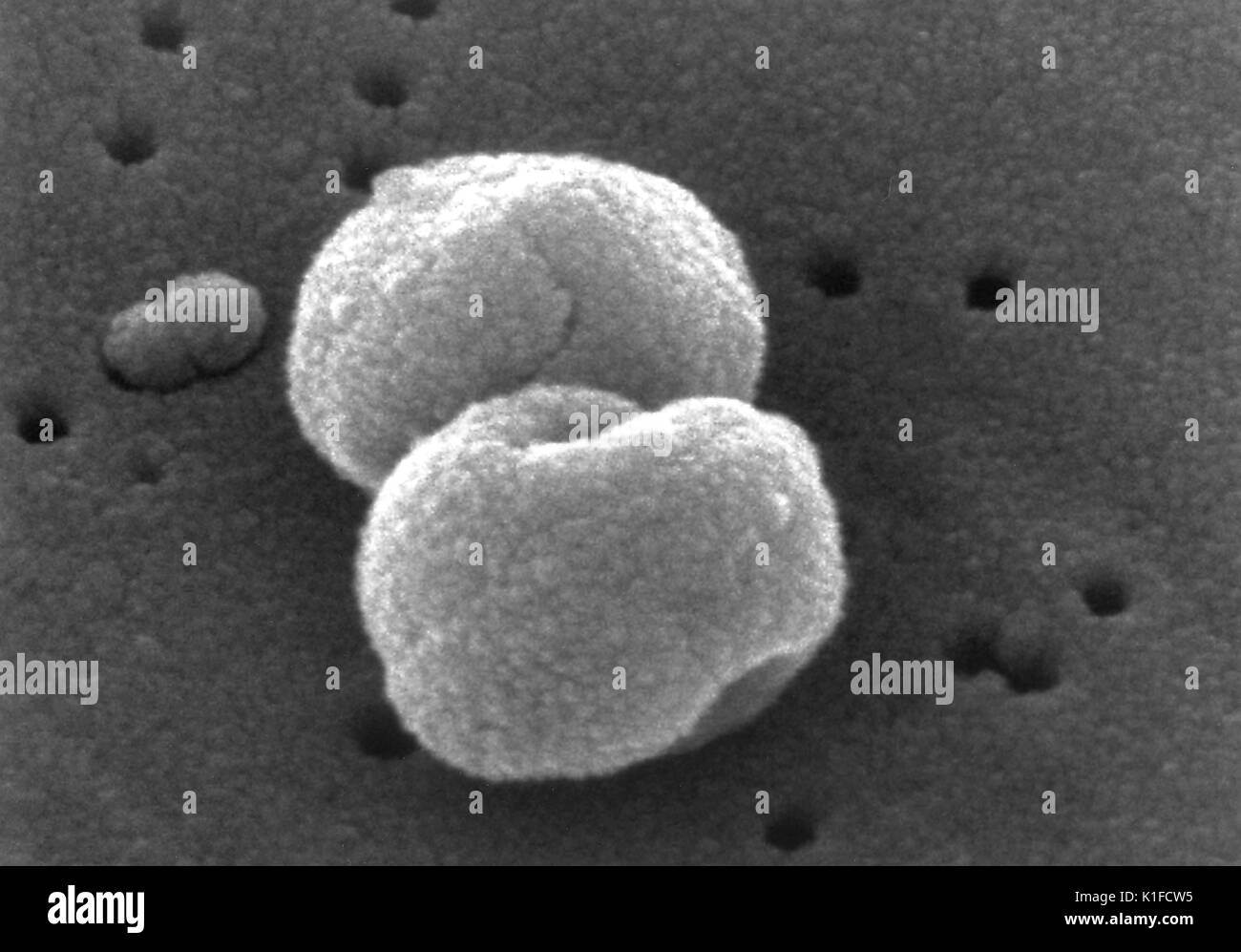 Scanning Electron Micrograph (SEM) eine Reihe von Gram-positiven Bakterien Streptokokkus pneumoniae. Bild mit freundlicher Genehmigung von CDC/Dr. Richard Facklam. 1982. Stockfoto