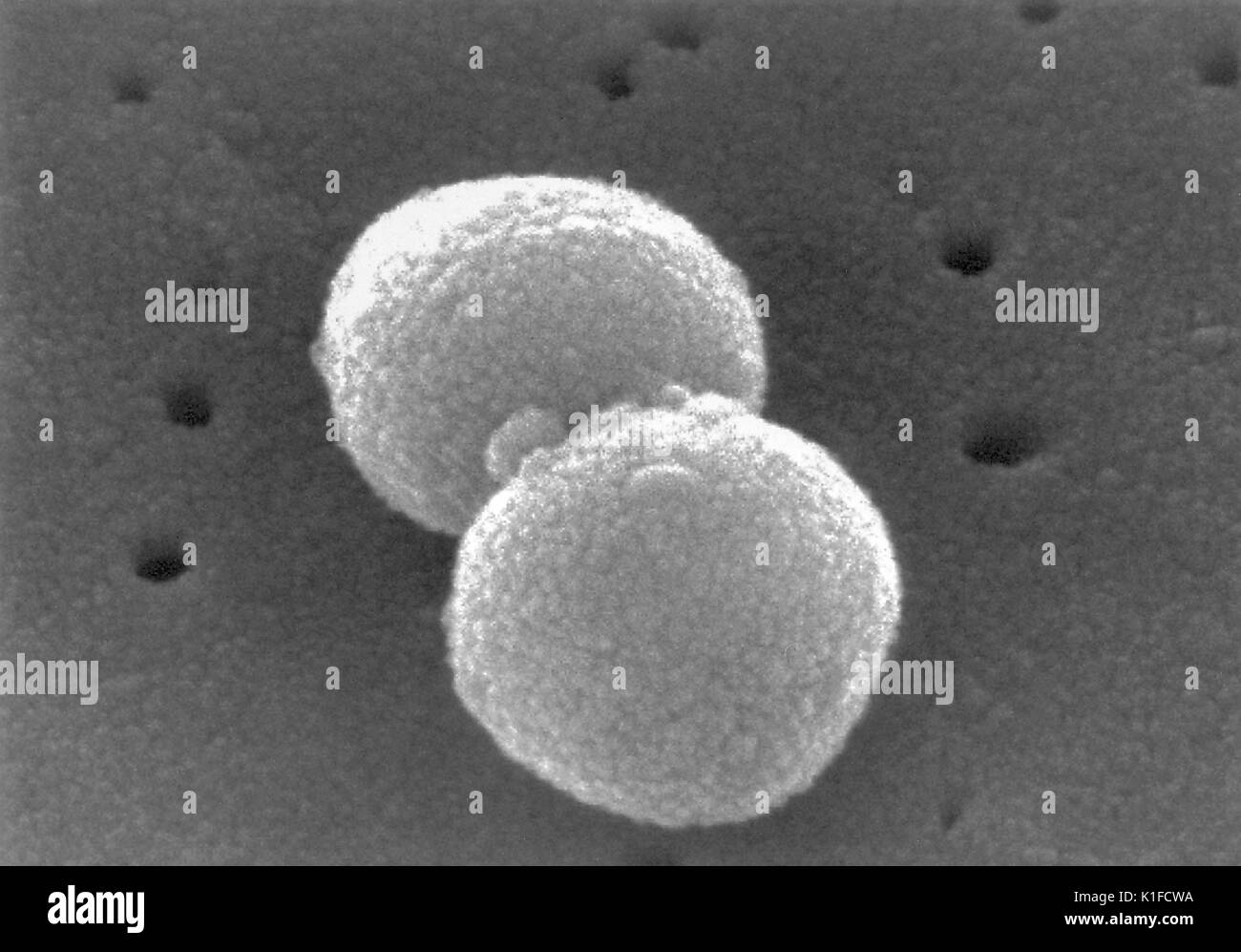 Scanning Electron Micrograph (SEM) eine Reihe von Gram-positiven Bakterien Streptokokkus pneumoniae. Bild mit freundlicher Genehmigung von CDC/Dr. Richard Facklam. 1982. Stockfoto