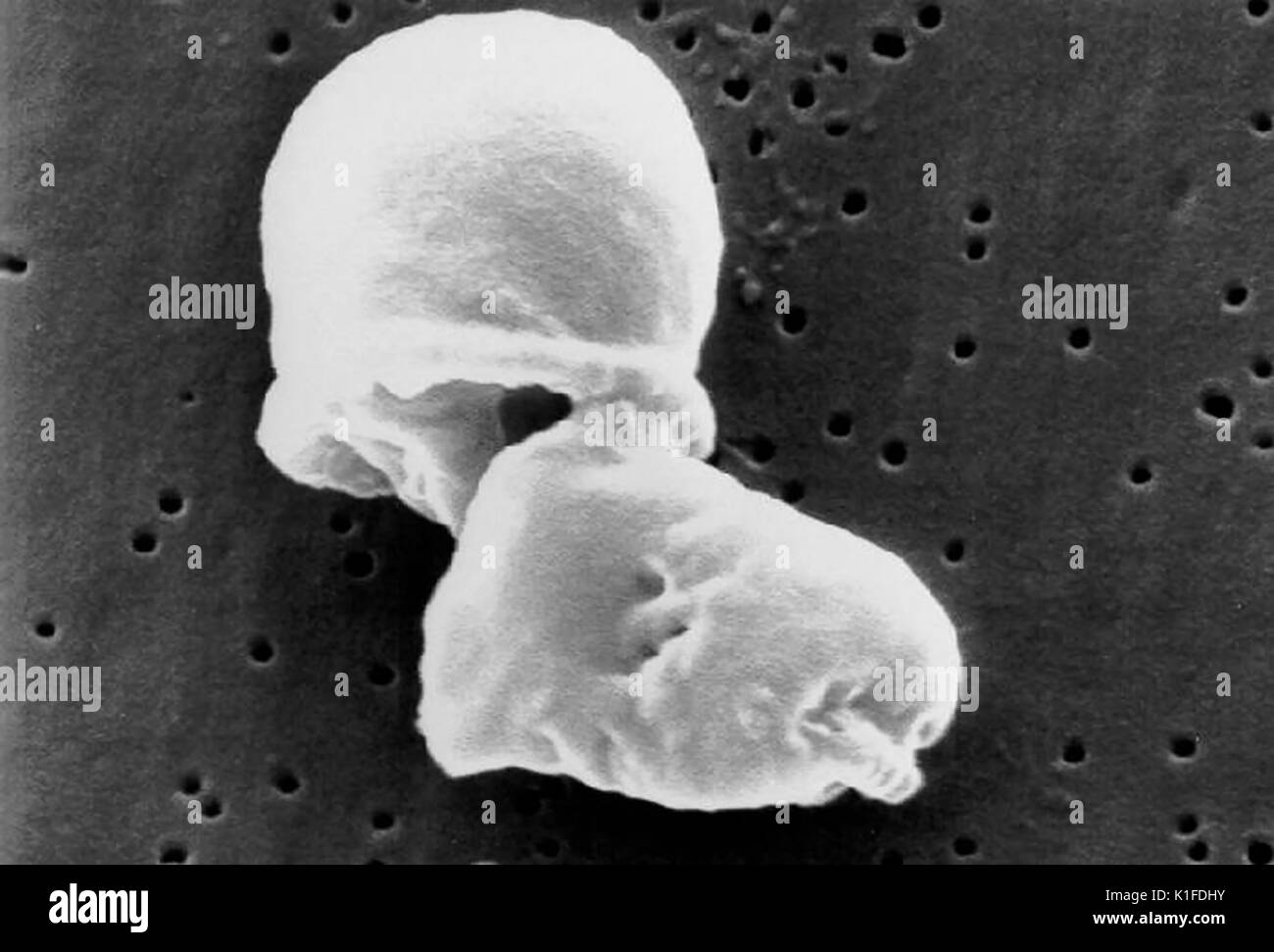Scanning Electron Micrograph (SEM) von Malassezia sp. pilzlicher Organismen. Mit freundlicher CDC. 1984. Stockfoto