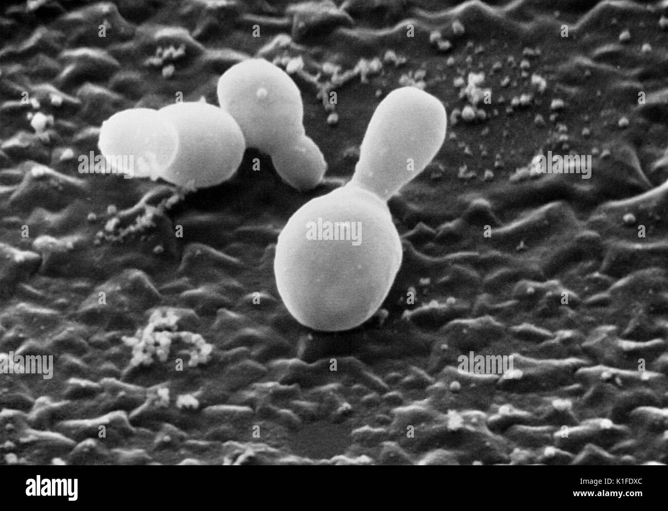 Malassezia furfur Fotos und Bildmaterial in hoher Auflösung Alamy