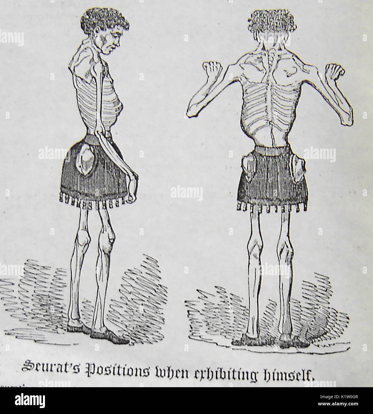 Echten viktorianischen Freak Show Ausstellung Claude Seurat, berechnet als das menschliche Skelett. Er sprach von einem 5 Meter langen bandwurm zu leiden Stockfoto
