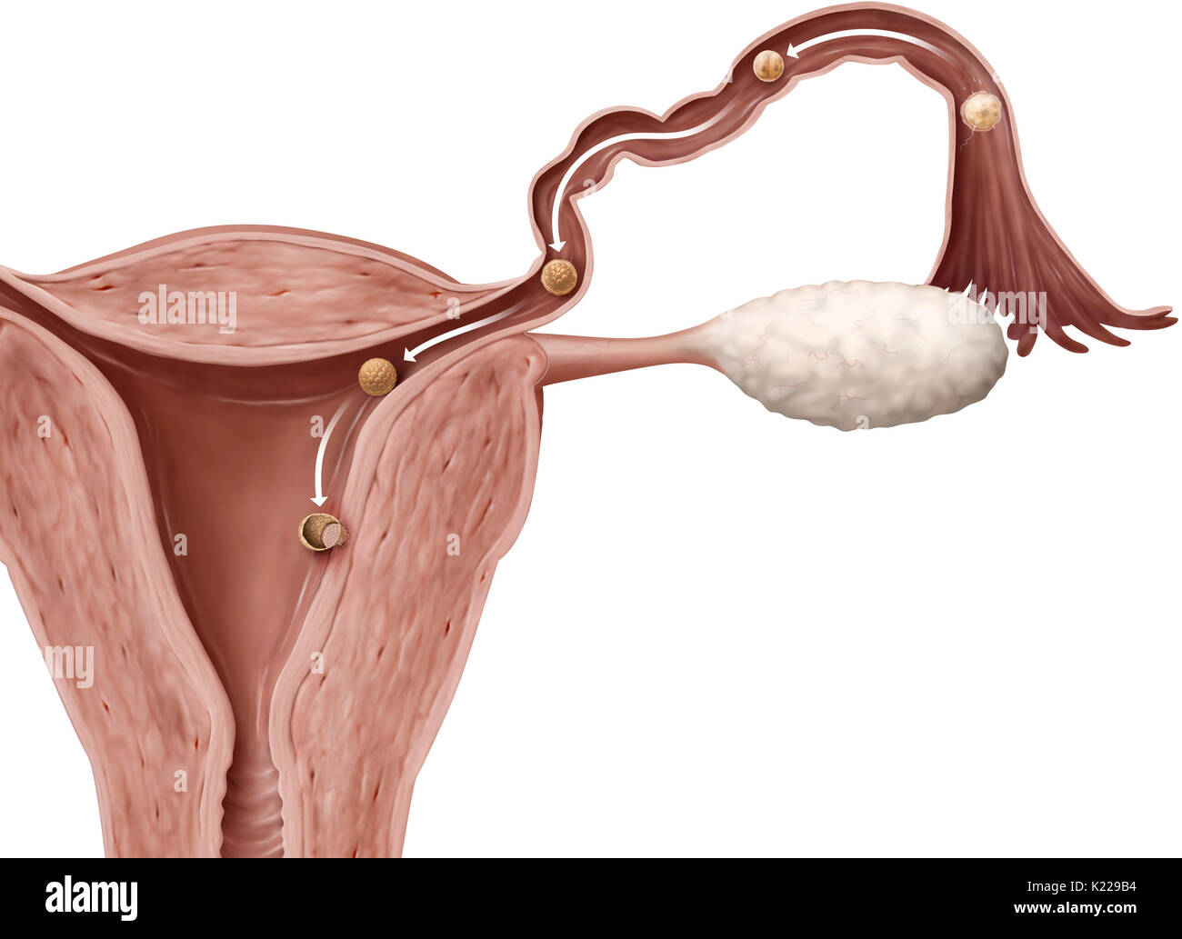 Nidation ist die Einnistung einer befruchteten Eizelle in der Gebärmutterschleimhaut, sechs oder sieben Tage nach der Befruchtung. Die Zellen der äußeren Schicht (Trophoblast) multiplizieren und das Endometrium, die es ermöglicht, die Blastozyste es zu verankern. Die Implantation Phase dauert ca. eine Woche. Stockfoto