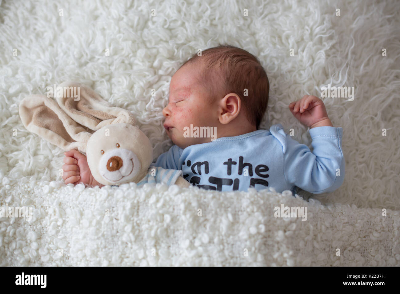 Dem kleinen neugeborenen Baby schläft mit Spielzeug, Baby mit nach Hautkontakt Hautausschlag