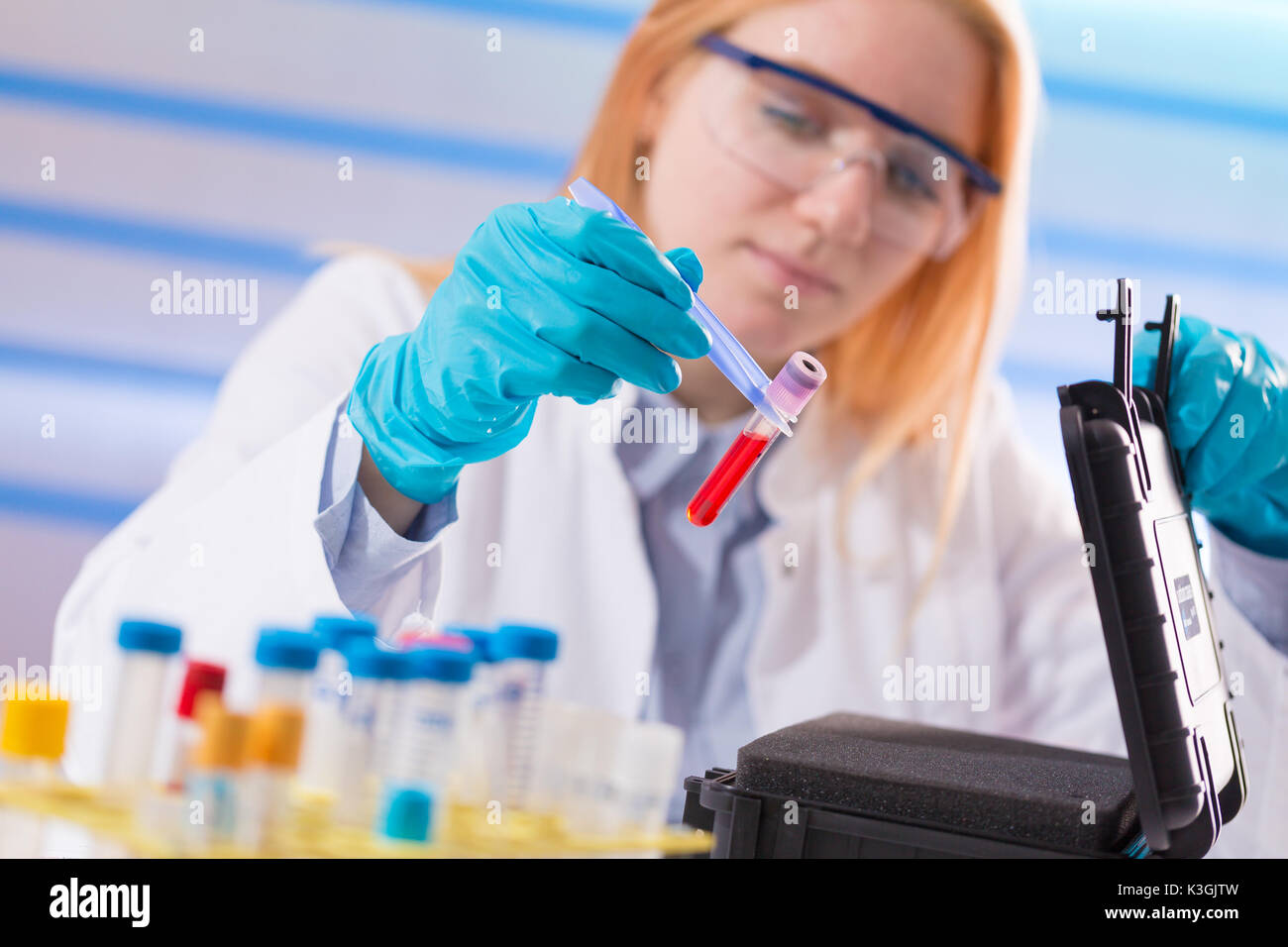 Weibliche Laboratory Assistant mit Blutprobe für AIDS Stockfoto