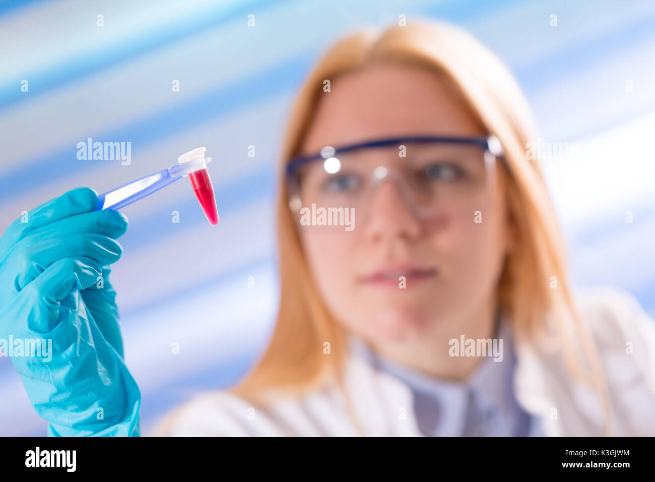 Weibliche Laboratory Assistant mit Blutprobe für AIDS Stockfoto