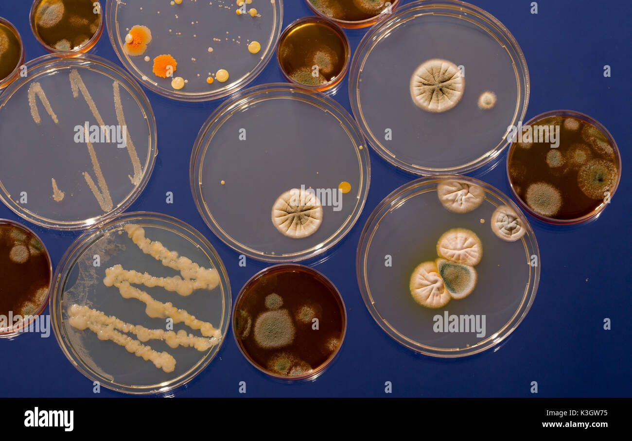 Eine Petrischale mit wachsenden Kulturen von Mikroorganismen, Pilze und Mikroben. Eine Petrischale (Petrie Teller) als Petrischalen oder Zelle bekannt - kulturschale Stockfoto