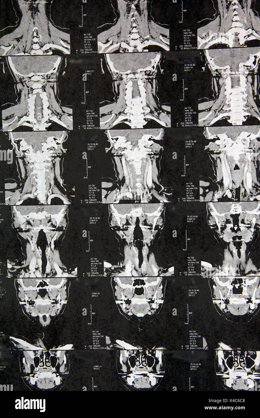 Radiologischen Untersuchung Stockfoto