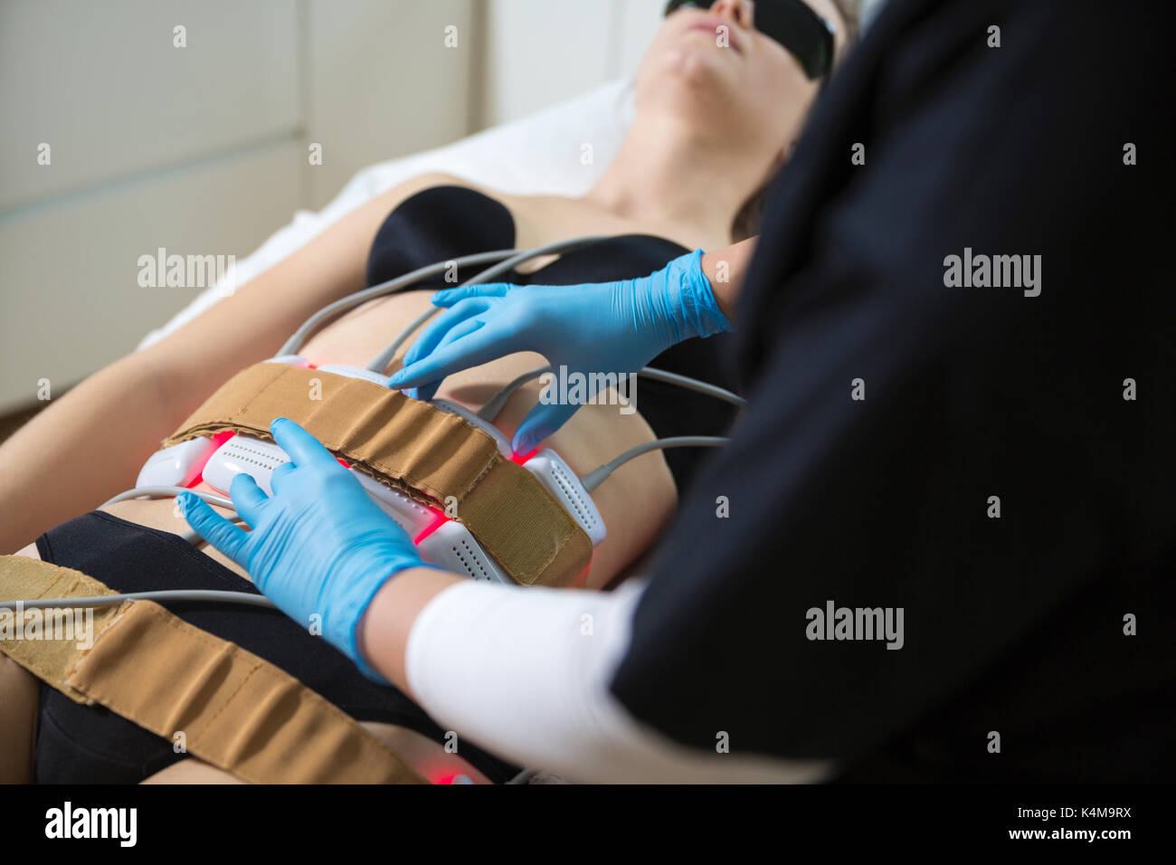 Kosmetikerin Durchführung fett Reduzierung Therapie mit kalten medizinische  Laser Stockfotografie - Alamy
