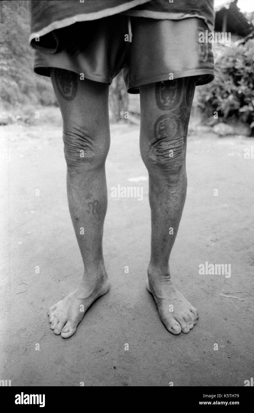 Die tätowierte Beine eines burmesischen Flüchtlinge in Shok La Flüchtlingslager im Nordwesten von Thailand; ein Lager nur für diejenigen mit Cholera Symptome. September, 1996. Stockfoto