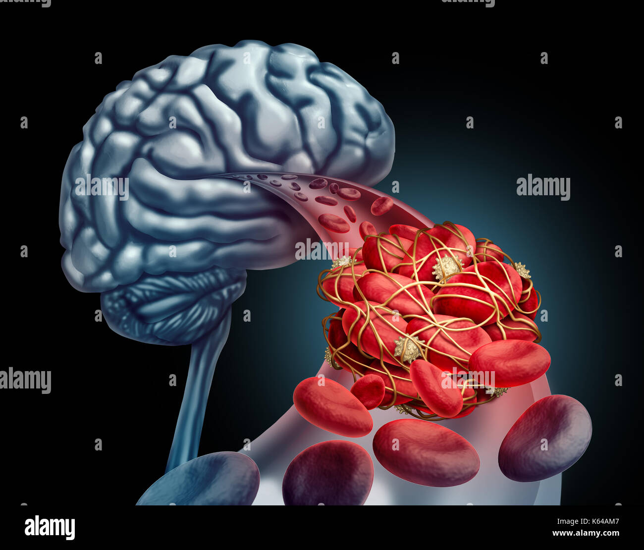 Blutgerinnsel im Gehirn medizinisches Konzept als 3D-Illustration Blutzellen durch eine Arterie Blockierung Thrombus, wodurch eine Blockierung des Blutflusses blockiert. Stockfoto
