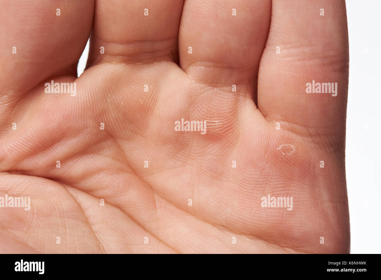 Makro von harter Arbeiter hand mit kallus Stockfoto