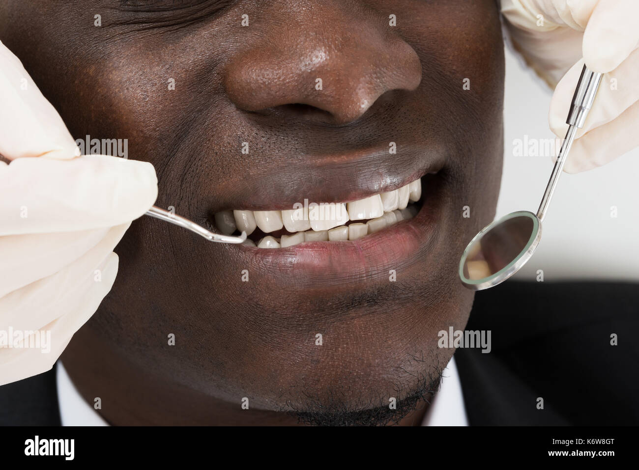 In der Nähe von Doktor Hände tun zahnmedizinische Bis der männlichen afrikanischen Patienten prüfen Stockfoto