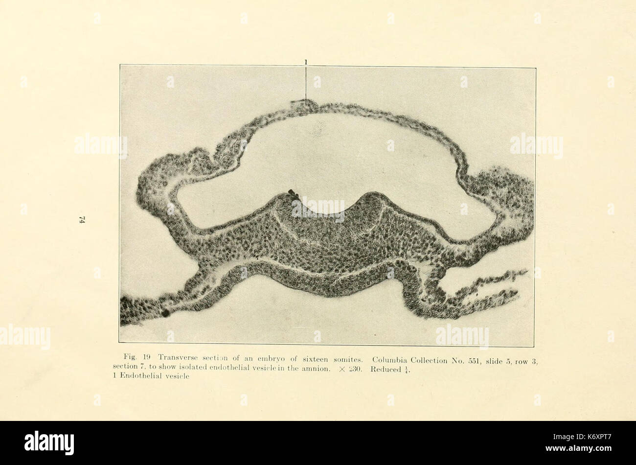 Frühe Stadien der Vaskulogenese in der Katze (Felis domestica) mit besonderer Bezugnahme auf die mesenschymal Ursprung des Endothels (Seite 74) BHL 17043987 Stockfoto