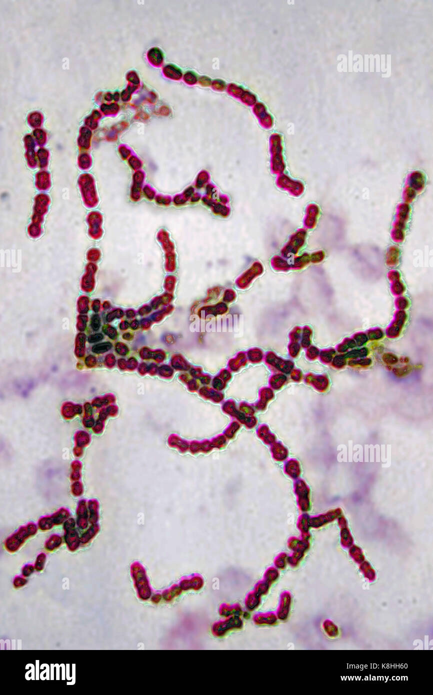 STREPTOCOCCUS PYOGENES Stockfoto