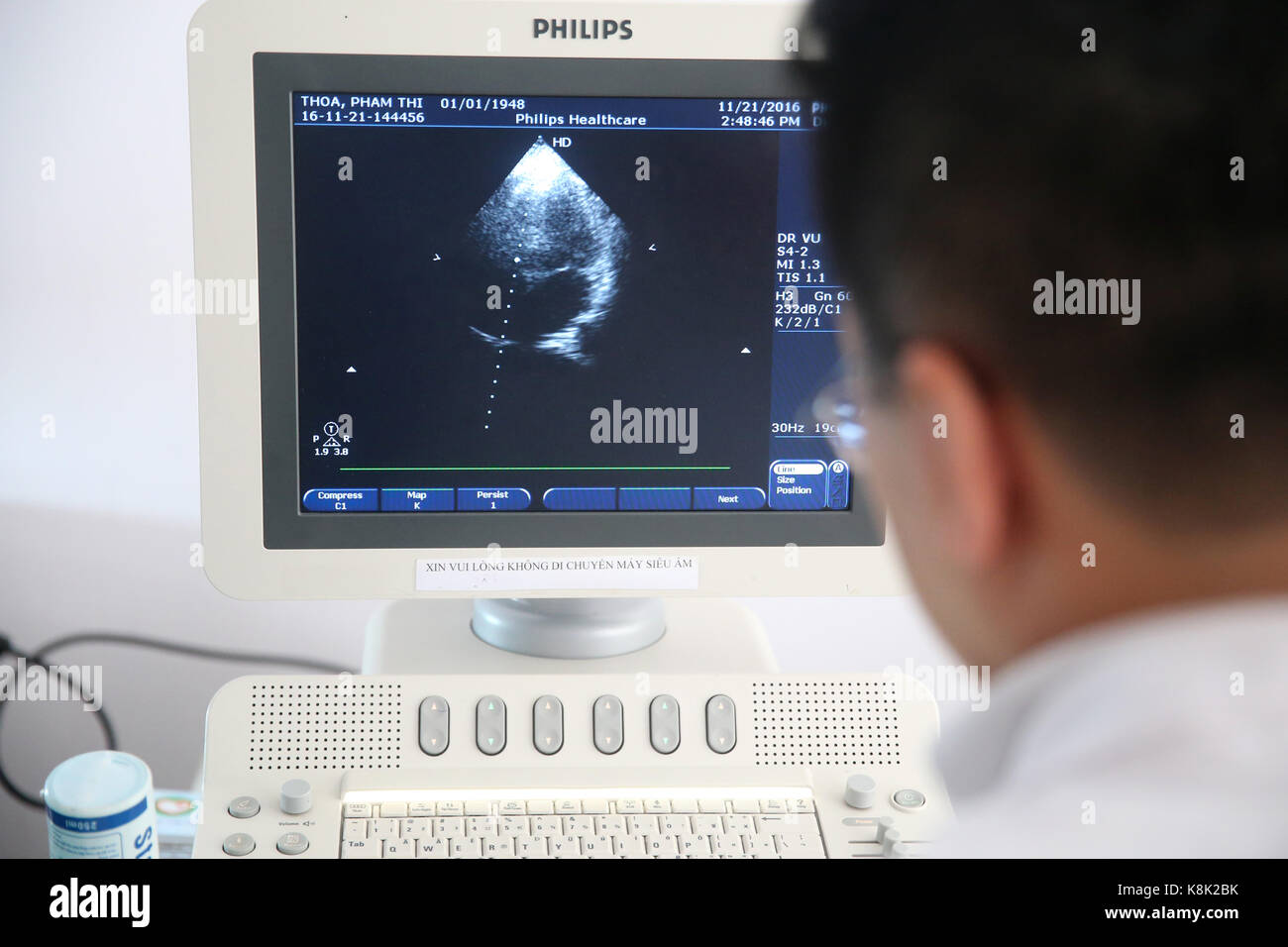 Tam duc Heart Hospital. Doppler Echokardiographie. Ho Chi Minh Stadt. Vietnam. Stockfoto