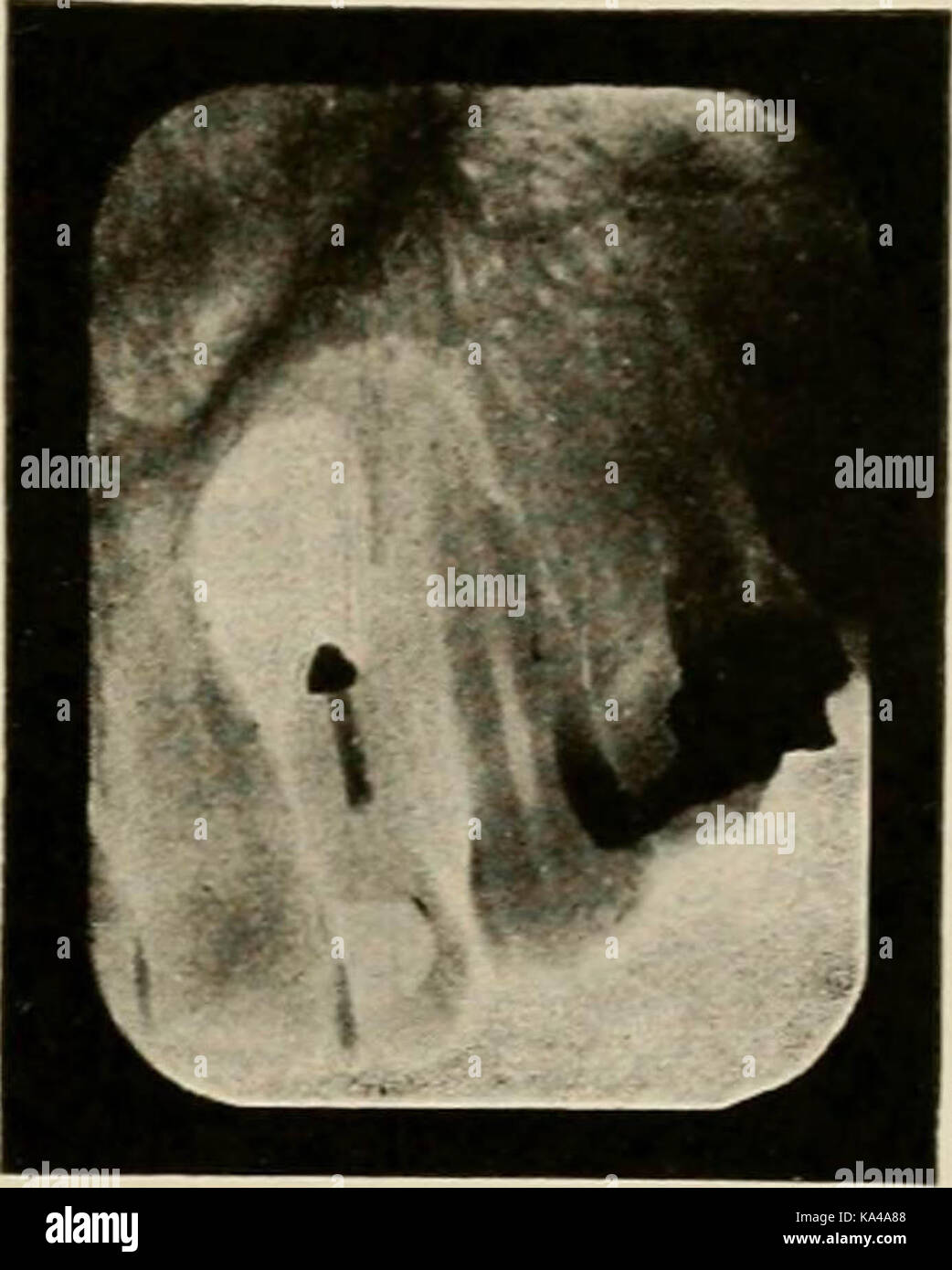 "Elementare und zahnmedizinische Radiographie/von Howard Riley Raper' (1918) Stockfoto