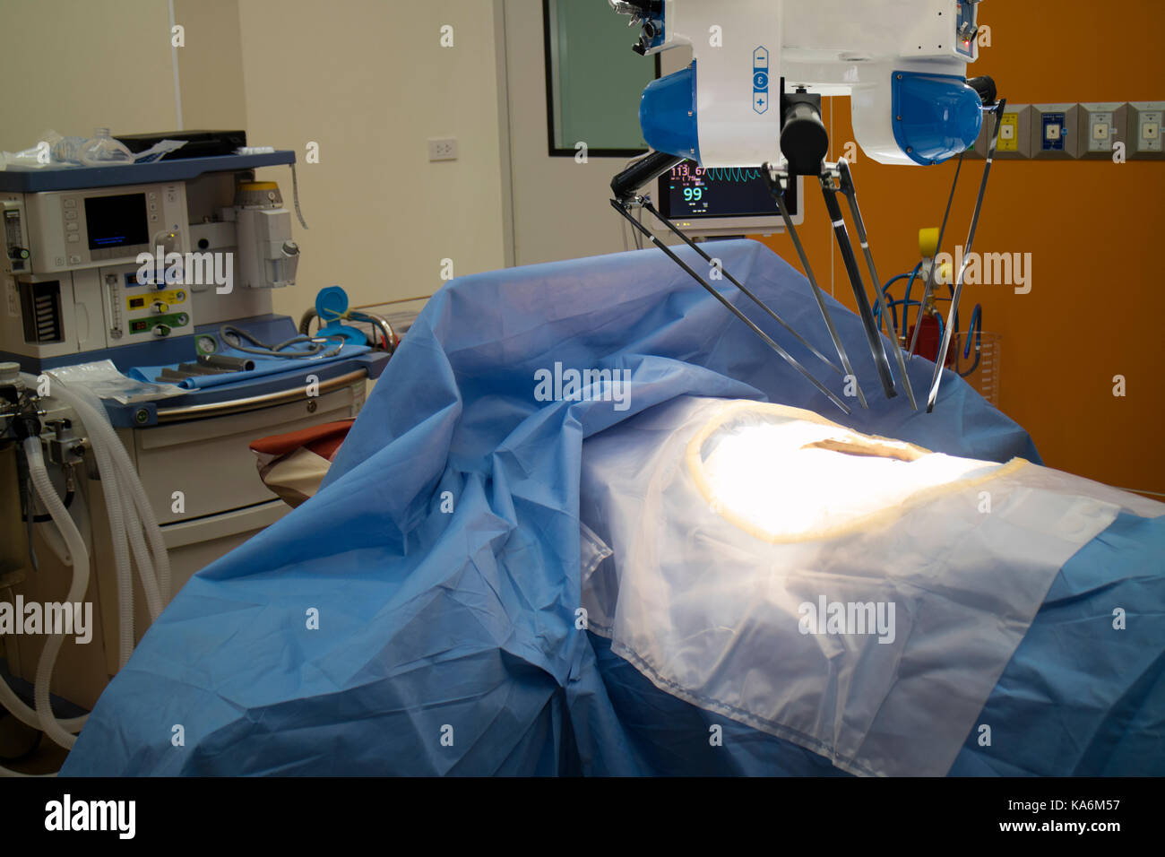Erweiterte Roboterchirurgie Maschine am Krankenhaus, einige der wichtigsten Vorteile der Roboterchirurgie sind Präzision und Miniaturisierung, kleinere Schnitte, weniger Stockfoto