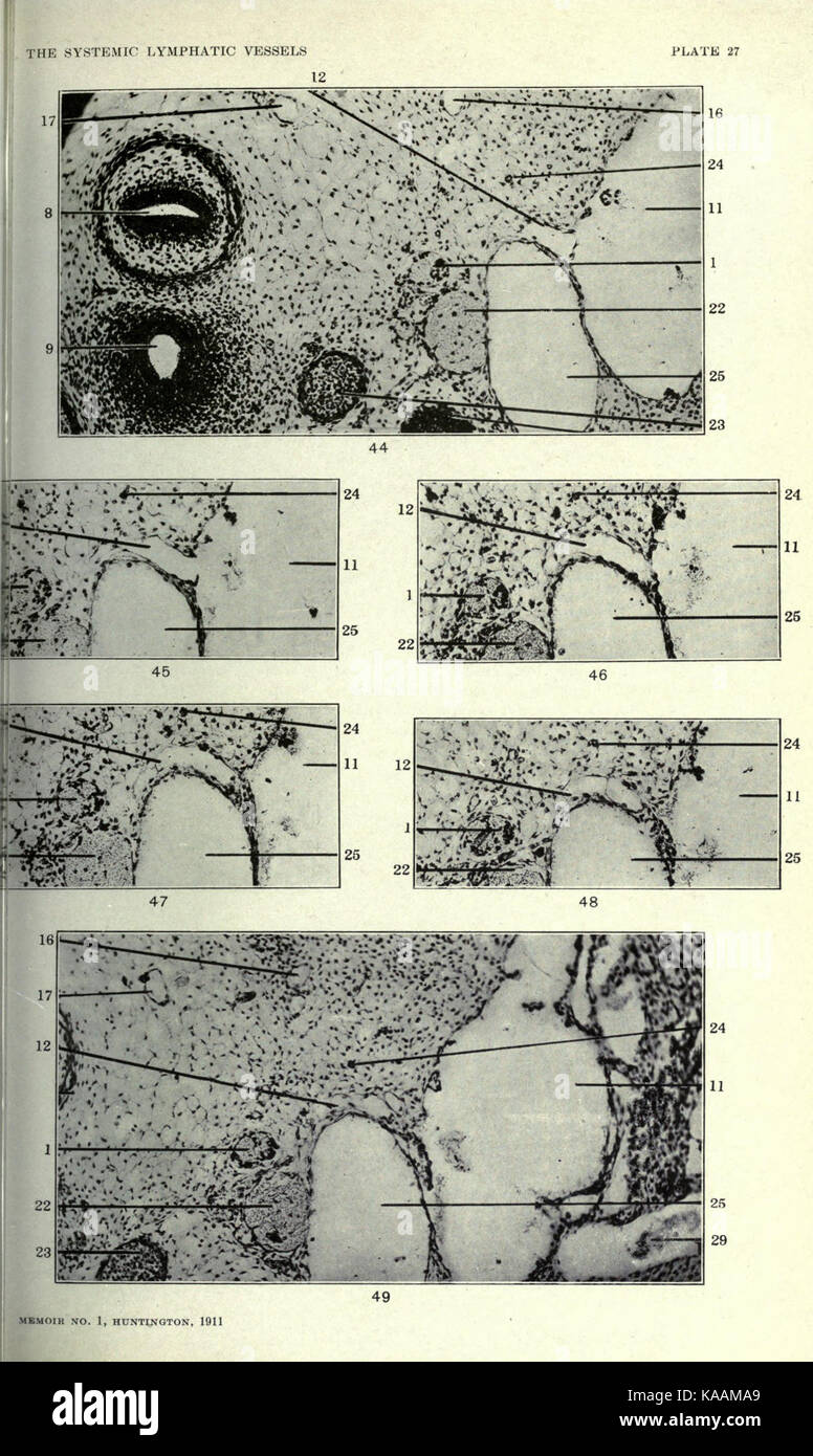 Die Anatomie und die Entwicklung der systemischen Lymphgefäße in der hauskatze BHL 23322340 Stockfoto
