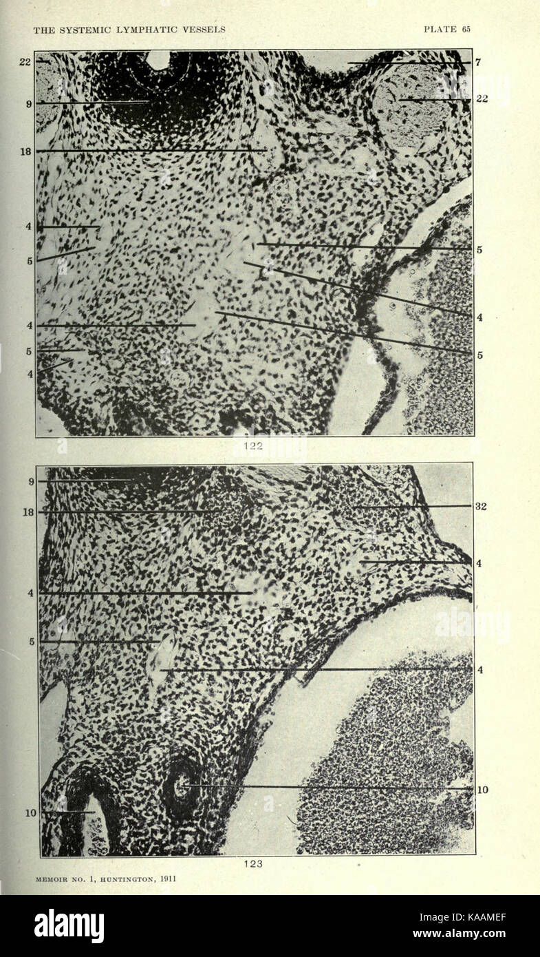 Die Anatomie und die Entwicklung der systemischen Lymphgefäße in der hauskatze BHL 23322440 Stockfoto