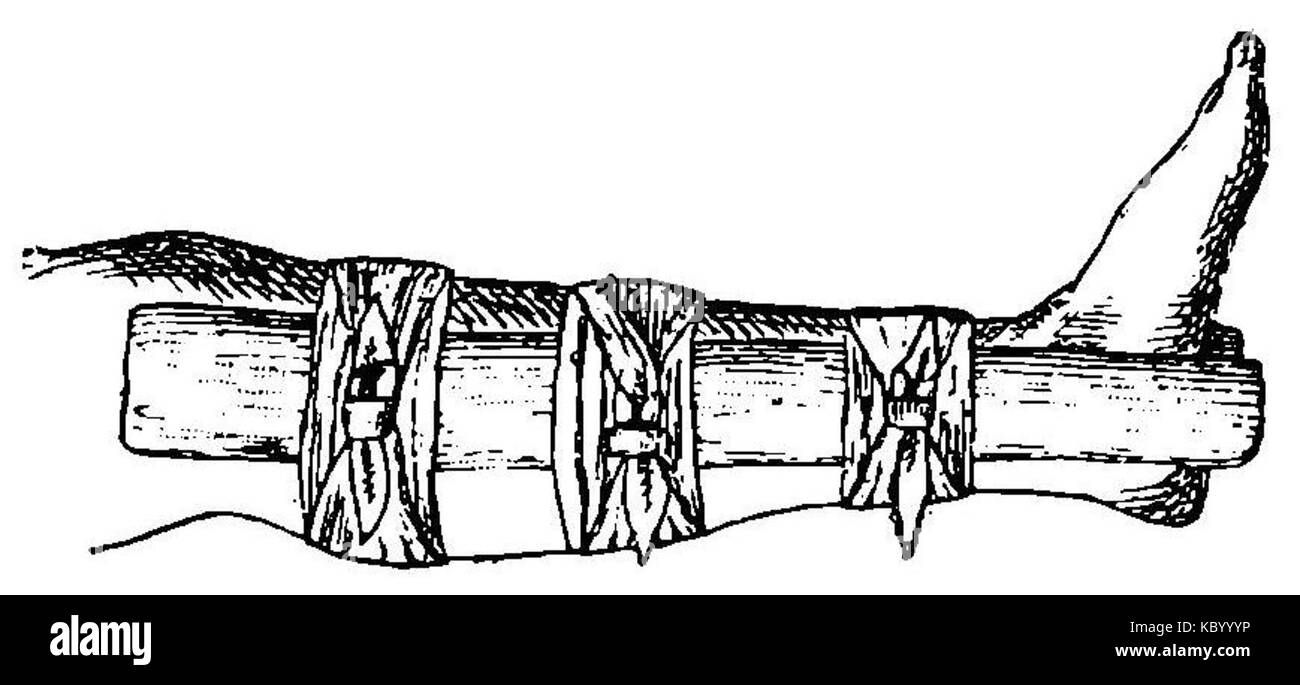 Grierson 37a Entablillado tablitas pierna de Con Stockfoto