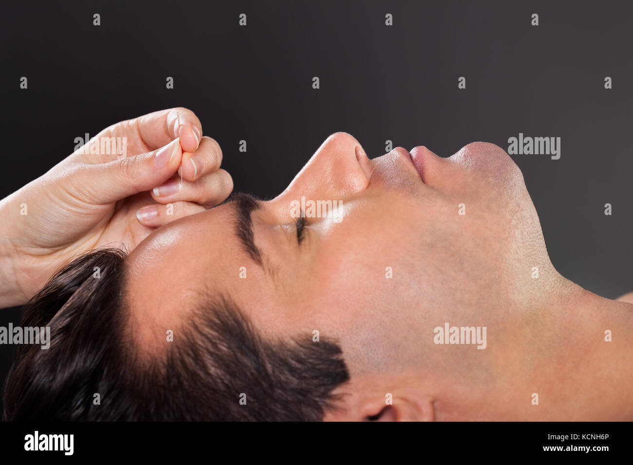 Nahaufnahme von einem jungen Mann, Akupunktur Stockfoto