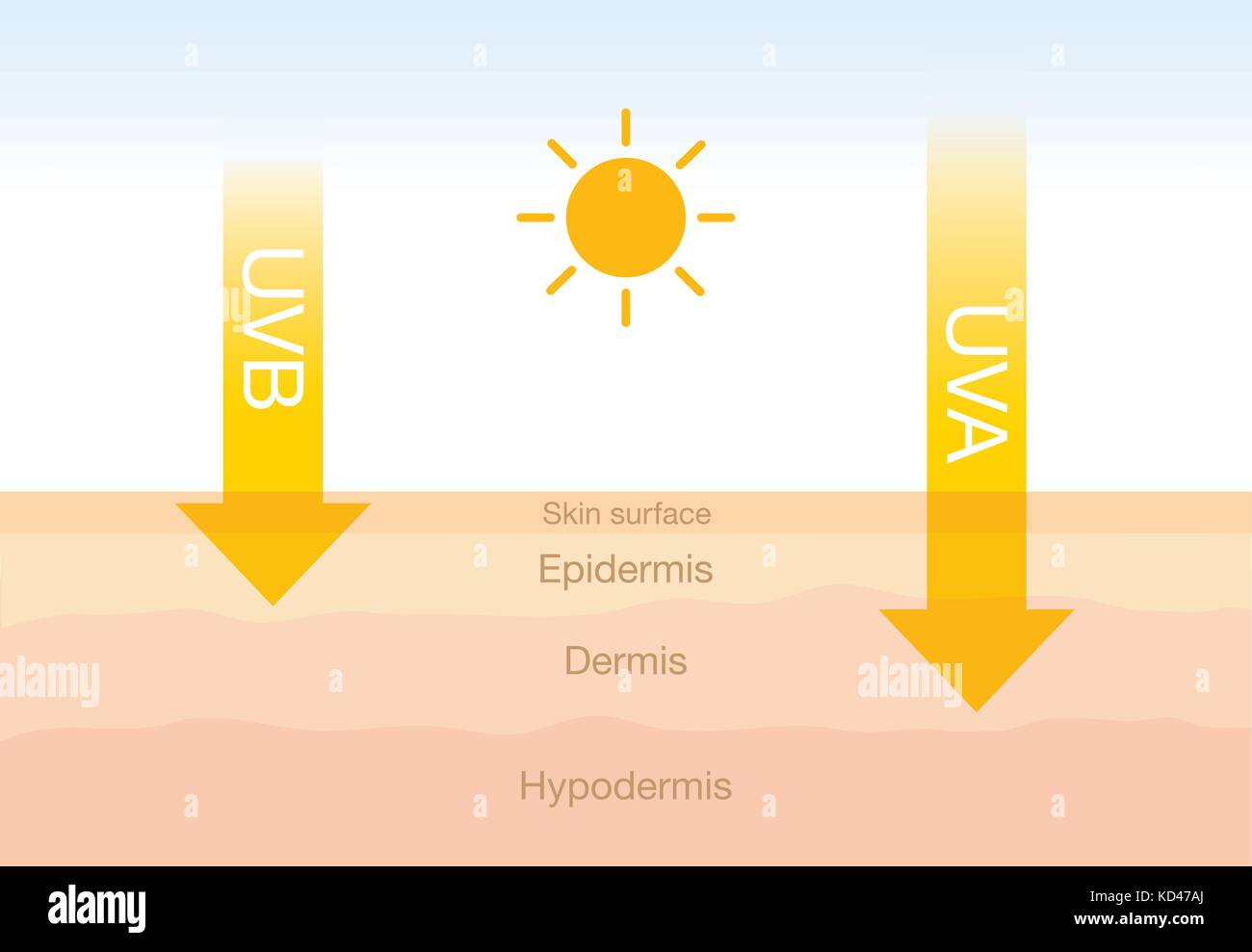 Der Unterschied von Strahlung 2 Arten im Sonnenlicht mit der Haut. Stock Vektor