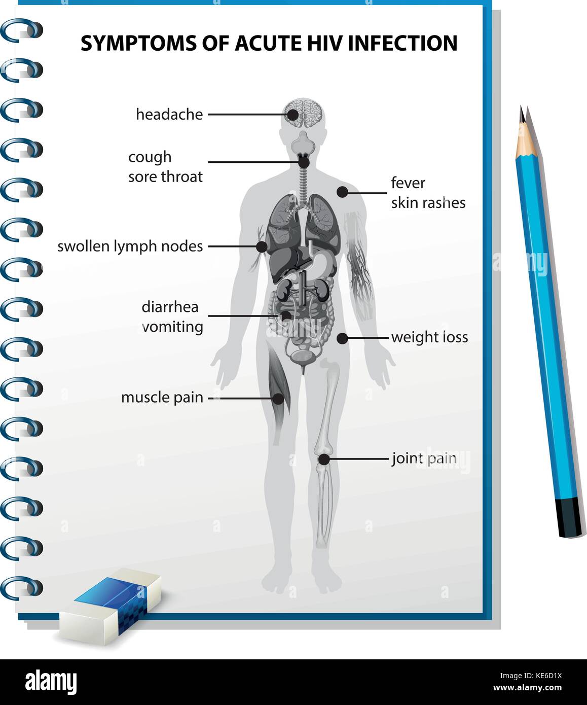 Symptome der akuten HIV-Infektion Diagramm Abbildung Stock Vektor