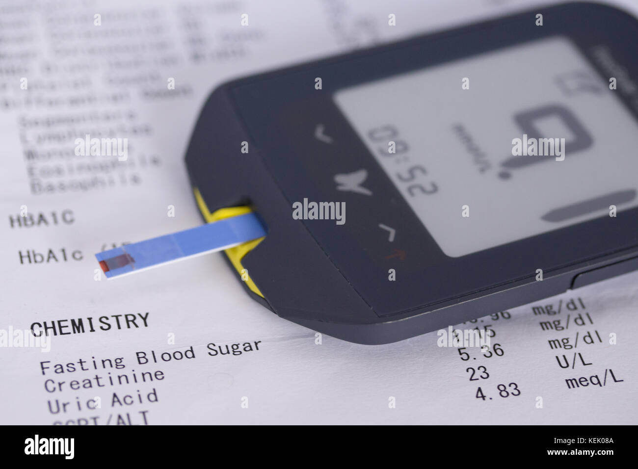 Diabetes-Blutmessgerät, das das Testergebnis anzeigt Stockfoto