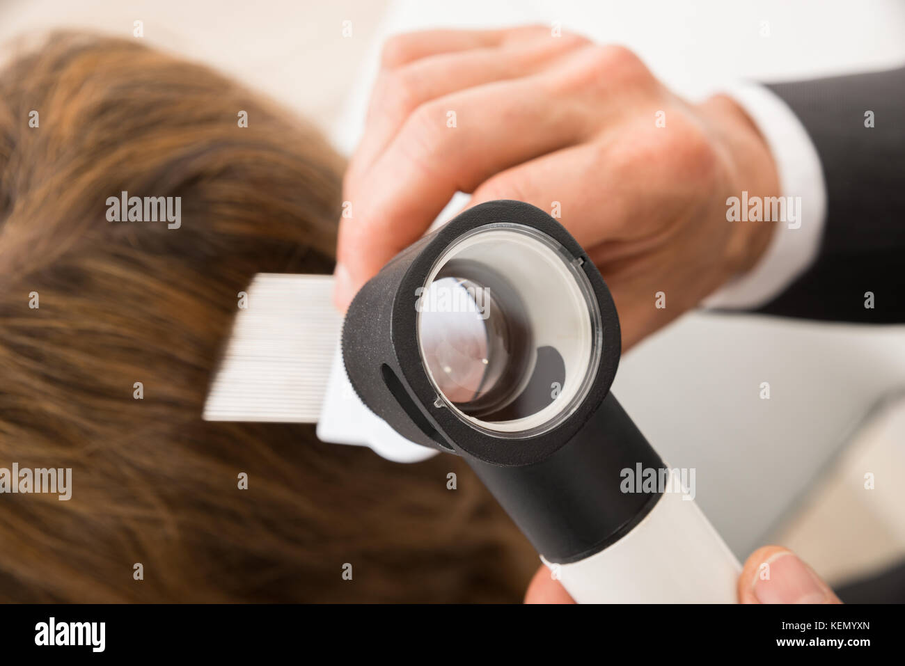 In der Nähe von Doktor hand mit Kamm und dermatoskop tun Behandlung des Patienten Haar Stockfoto