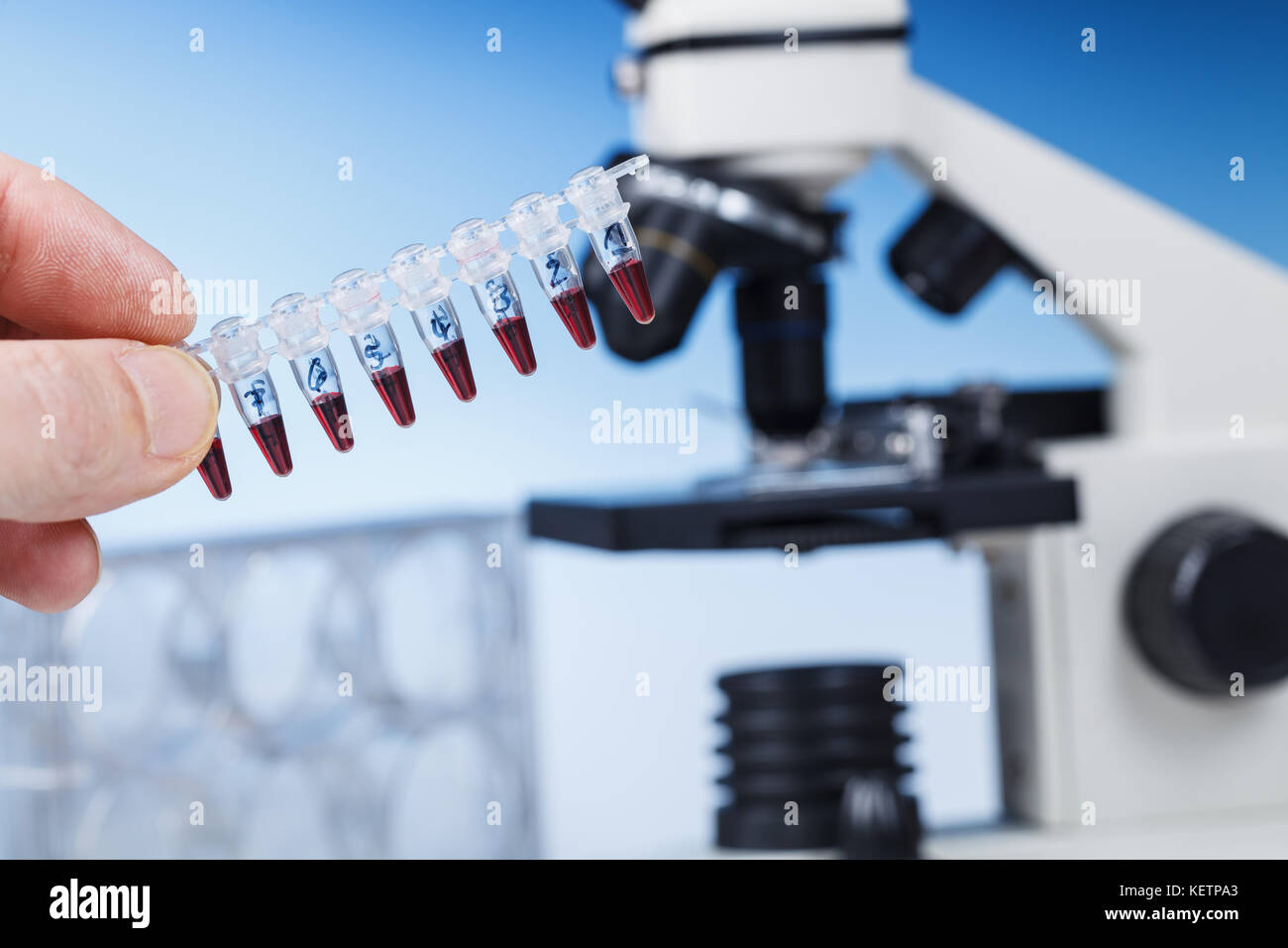 Mikroskop Thema Tabelle und biologische Proben. Mikroskop ist das wichtigste Instrument in vielen wissenschaftlichen mikrobiologischen Labors Stockfoto