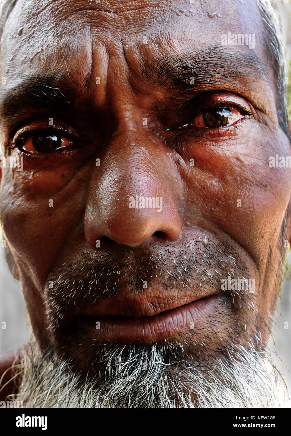 Bengalische muslimische Flüchtlinge im Hilfslager Udmari 1446 in Dhuburi. August 2012. Sie leiden unter Fieber und Ruhr.Credit: Dhruba Dutta/ImagesLive/ZUMA Wire/Alamy Live News Stockfoto