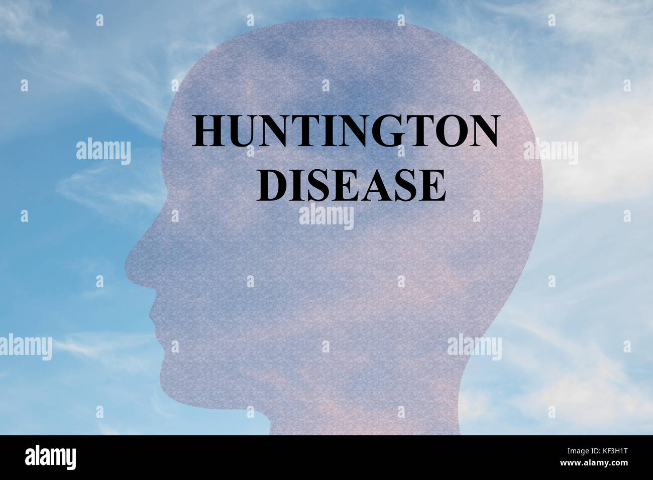 Darstellung des Titels „HUNTINGTON DISEASE“ auf Kopfsilhouette, mit bewölktem Himmel als Hintergrund. Stockfoto