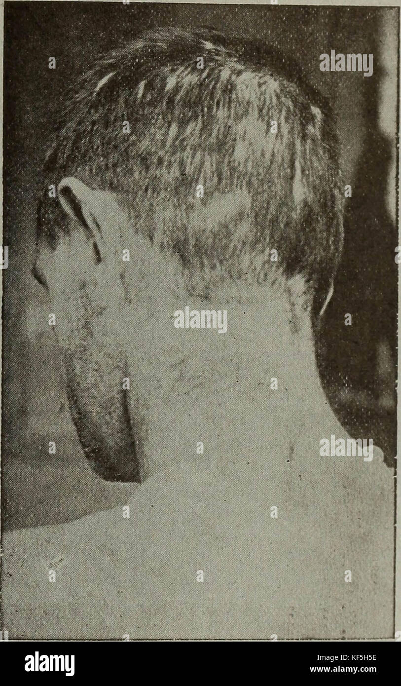 "Die richtige Pflege der Haare und Kopfhaut' (1917) Stockfoto