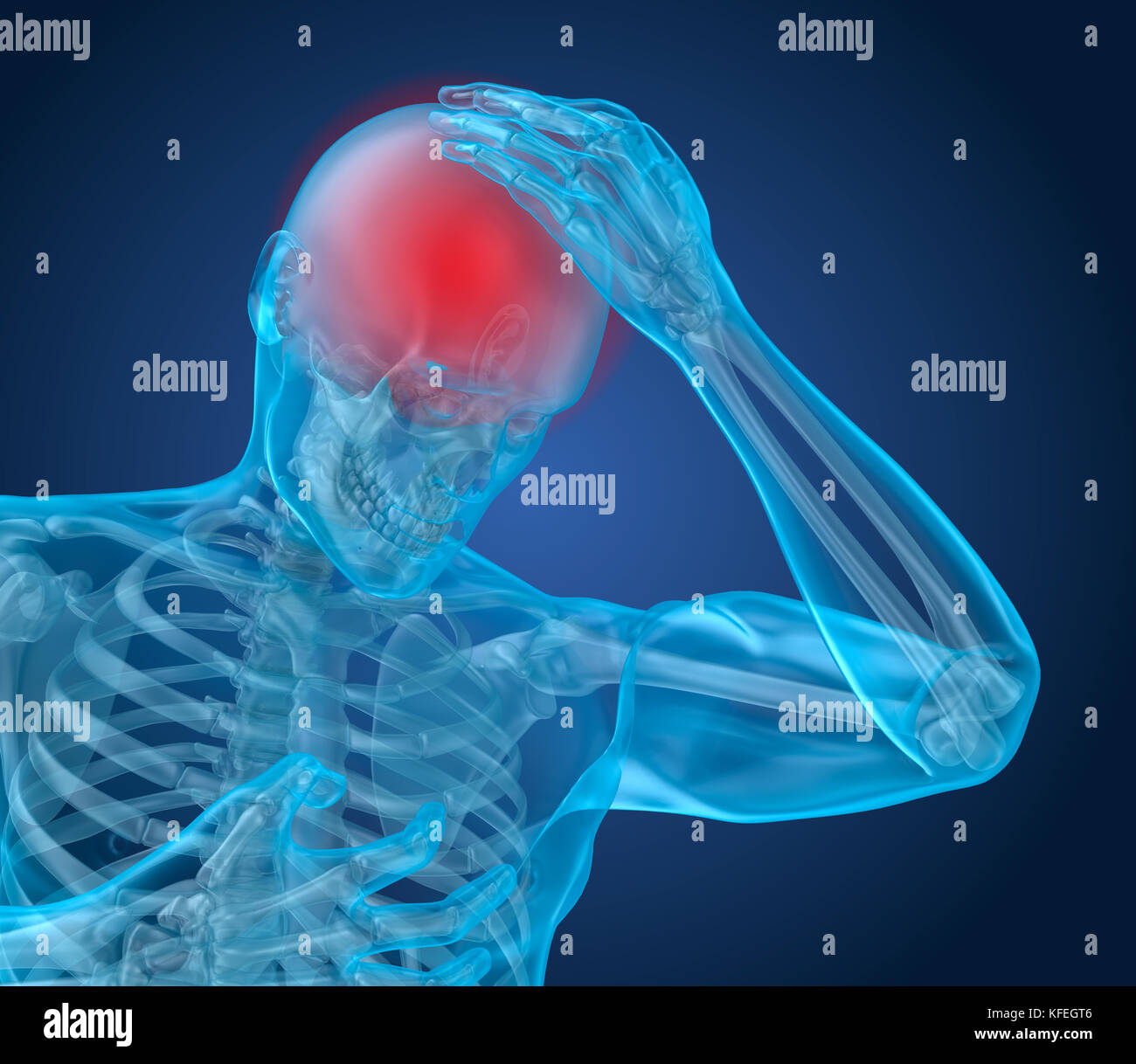 Kopf schmerzen Angriff, der Mensch Leiden Gehirn Schmerz. 3D-Darstellung Stockfoto
