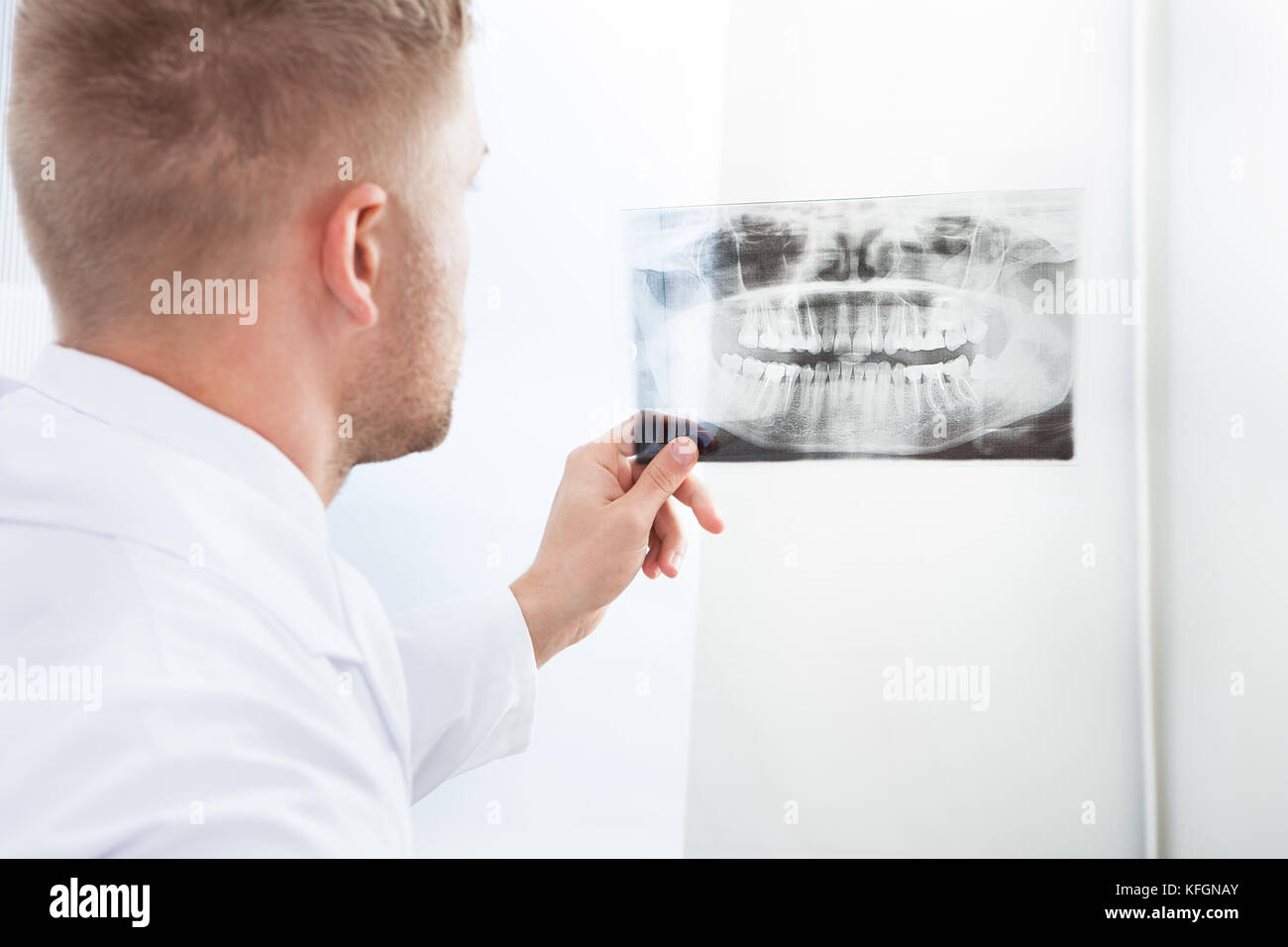 Arzt Studium eine x-ray film halten Sie es gegen das Licht, wie er seine Diagnose oder Schecks auf den Fortschritt der Behandlung macht Stockfoto