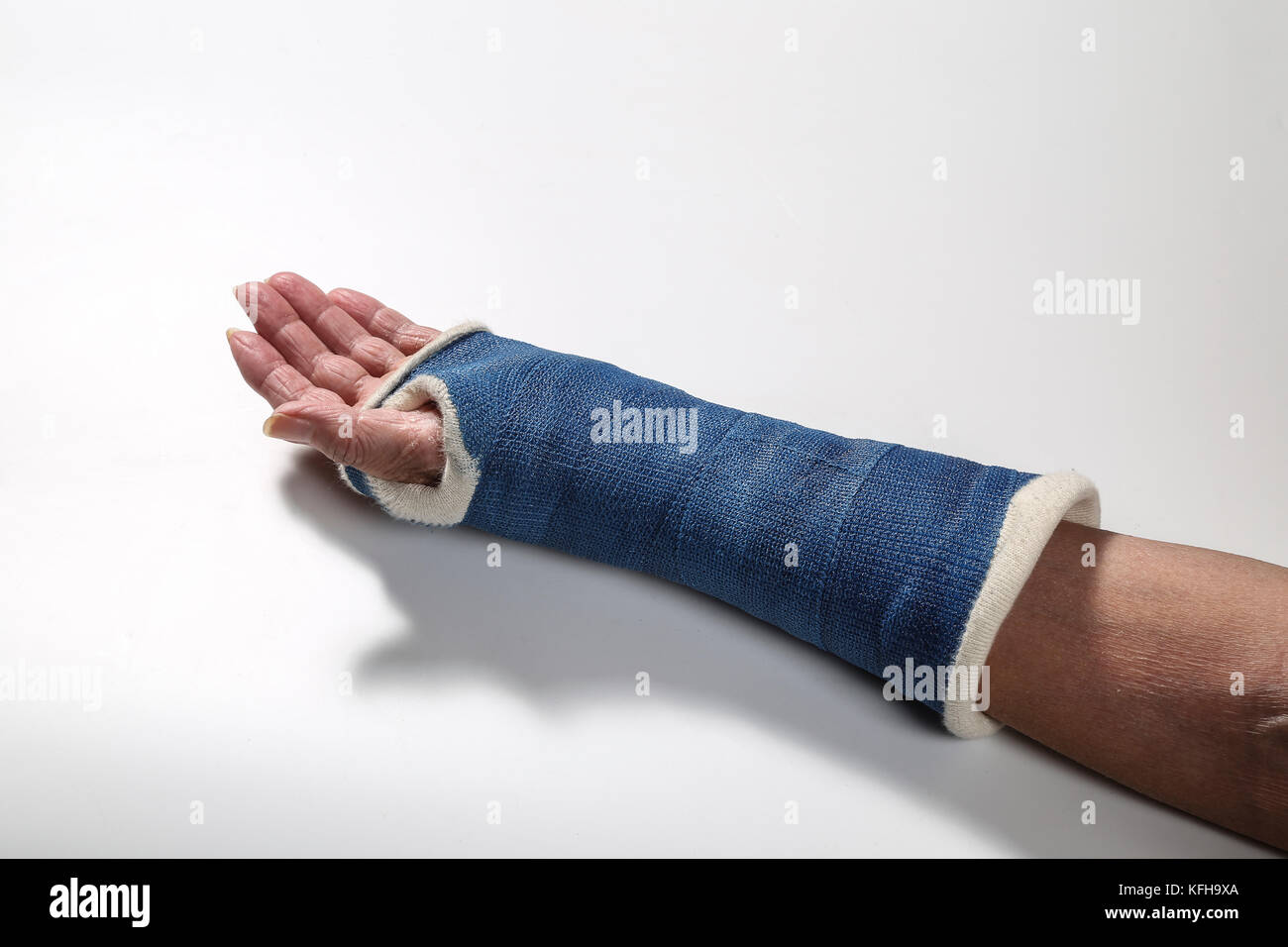 Damen Arm mit einem gebrochenen Handgelenk mit einem Topf auf. Weißer Hintergrund Stockfoto