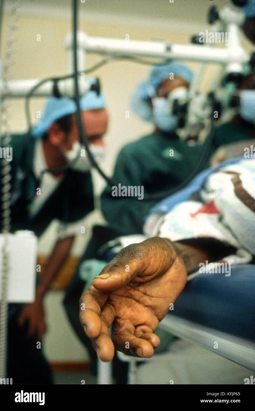 Auge Chirurgie, Simbabwe, Südafrika. Raleigh International partnered Op Auge Expeditionen (siehe ) Internationale auf eine Reihe von Expeditionen in der Bereitstellung von medizinischen, chirurgischen und Educational Services mit dem Ziel der Wiederherstellung der Sehkraft für blinde Personen. Stockfoto